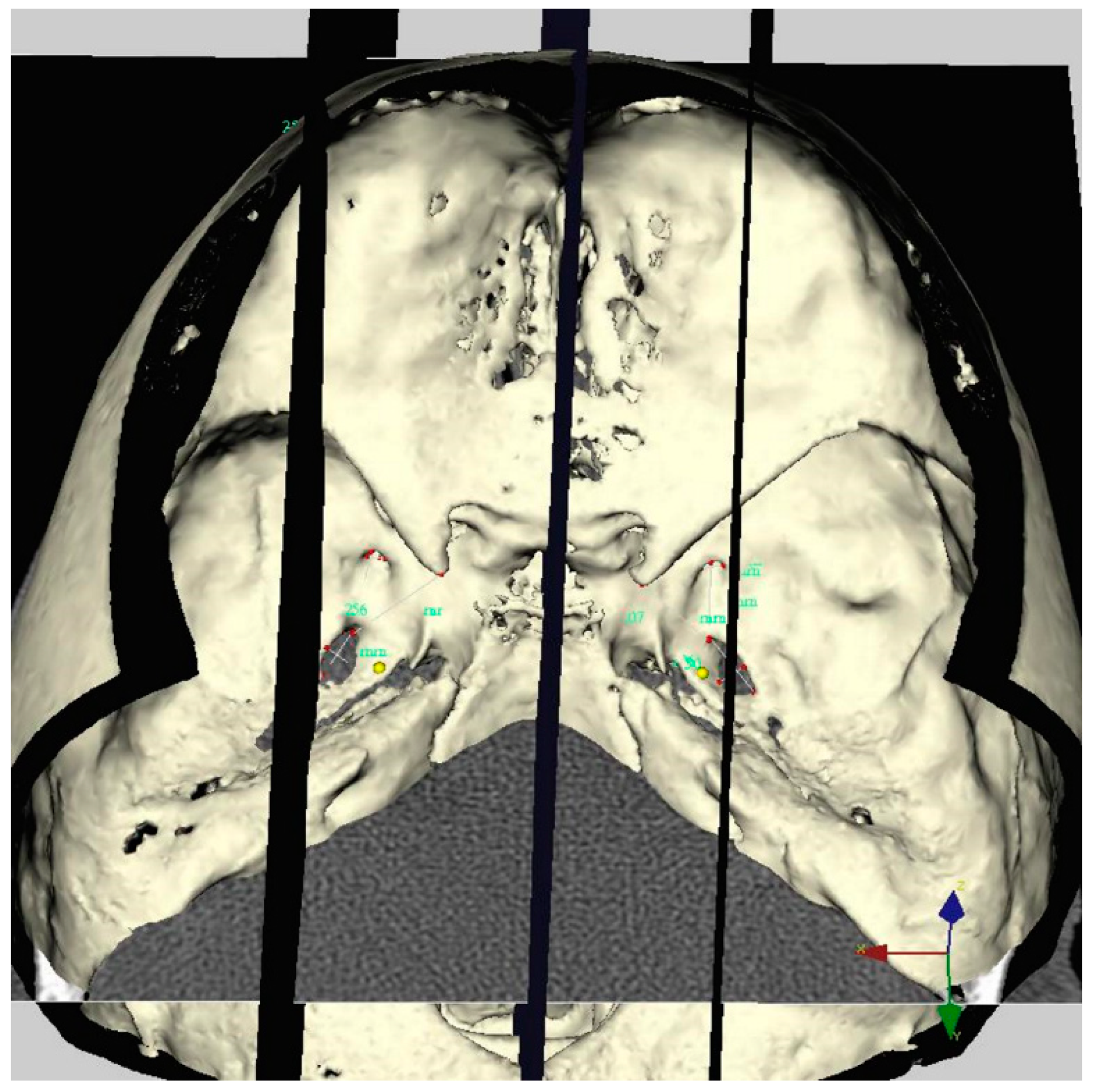 Diagnostics 12 00073 g003 550