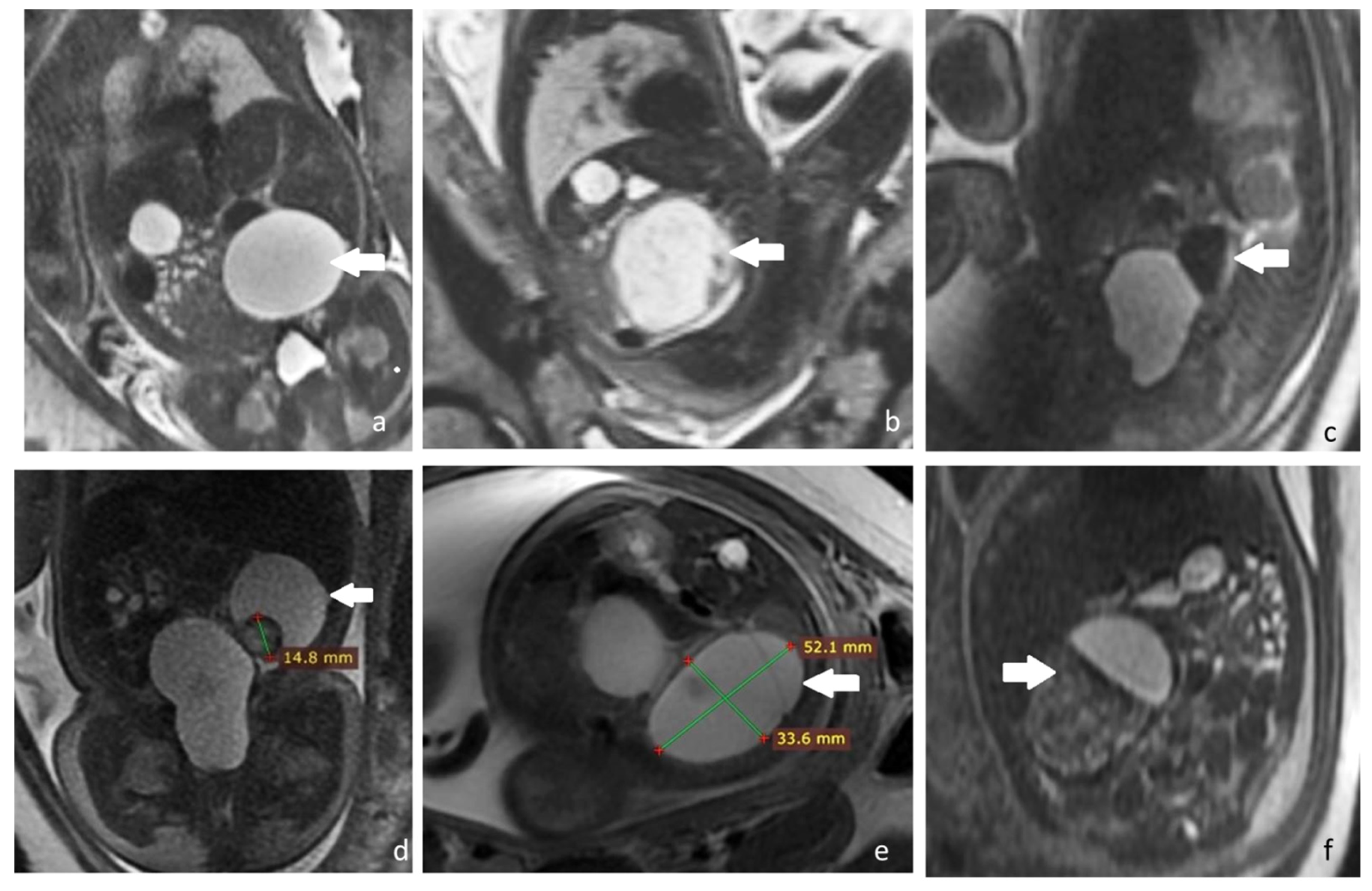 Diagnostics 12 00089 g004