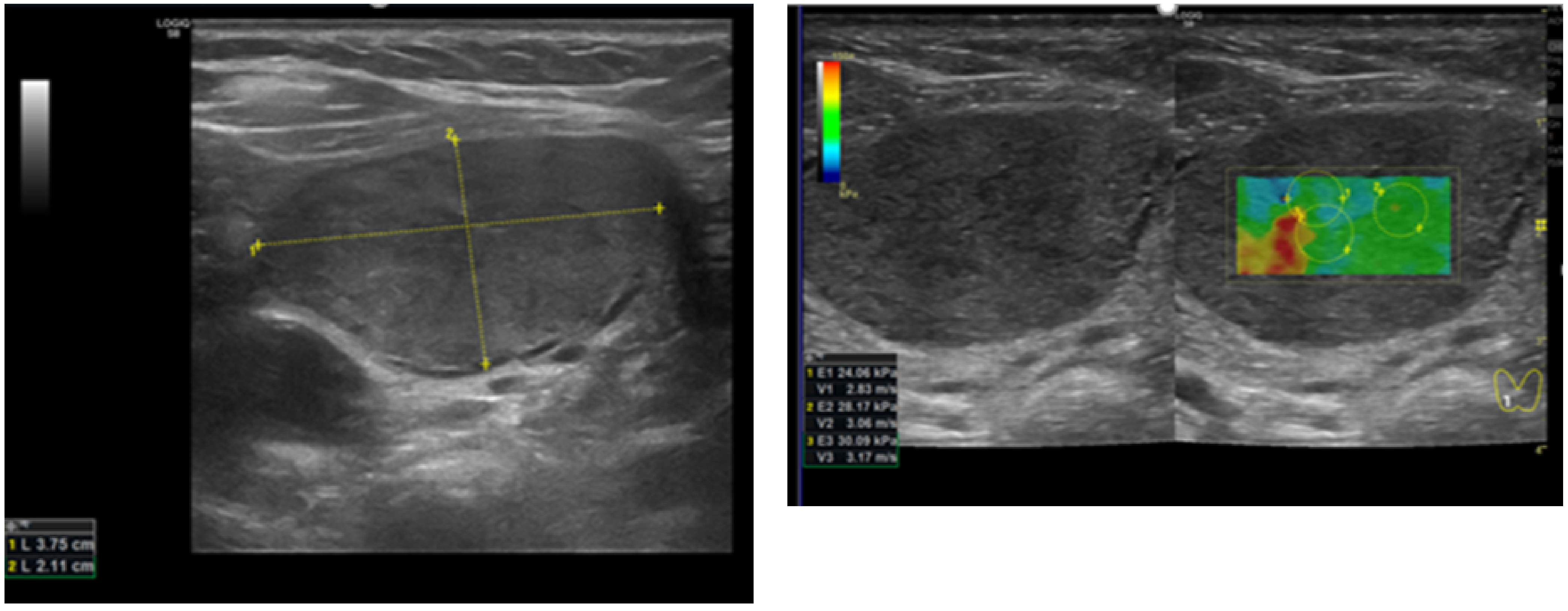 Diagnostics 12 00109 g002