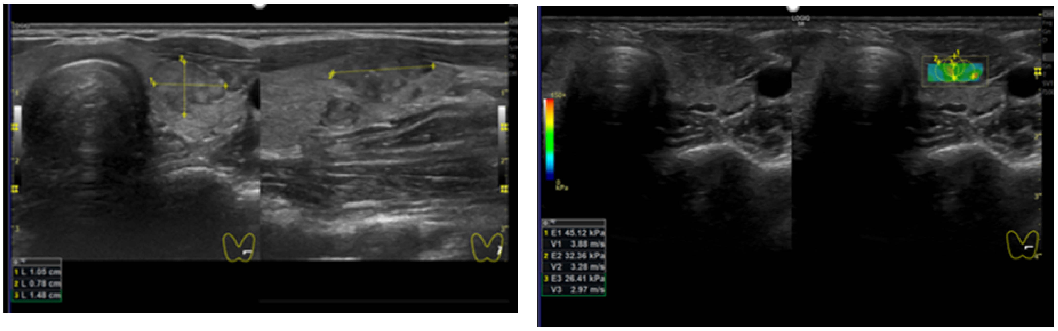 Diagnostics 12 00109 g003