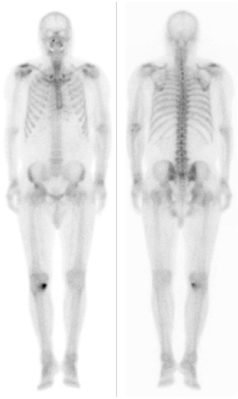 Diagnostics 12 00113 g004