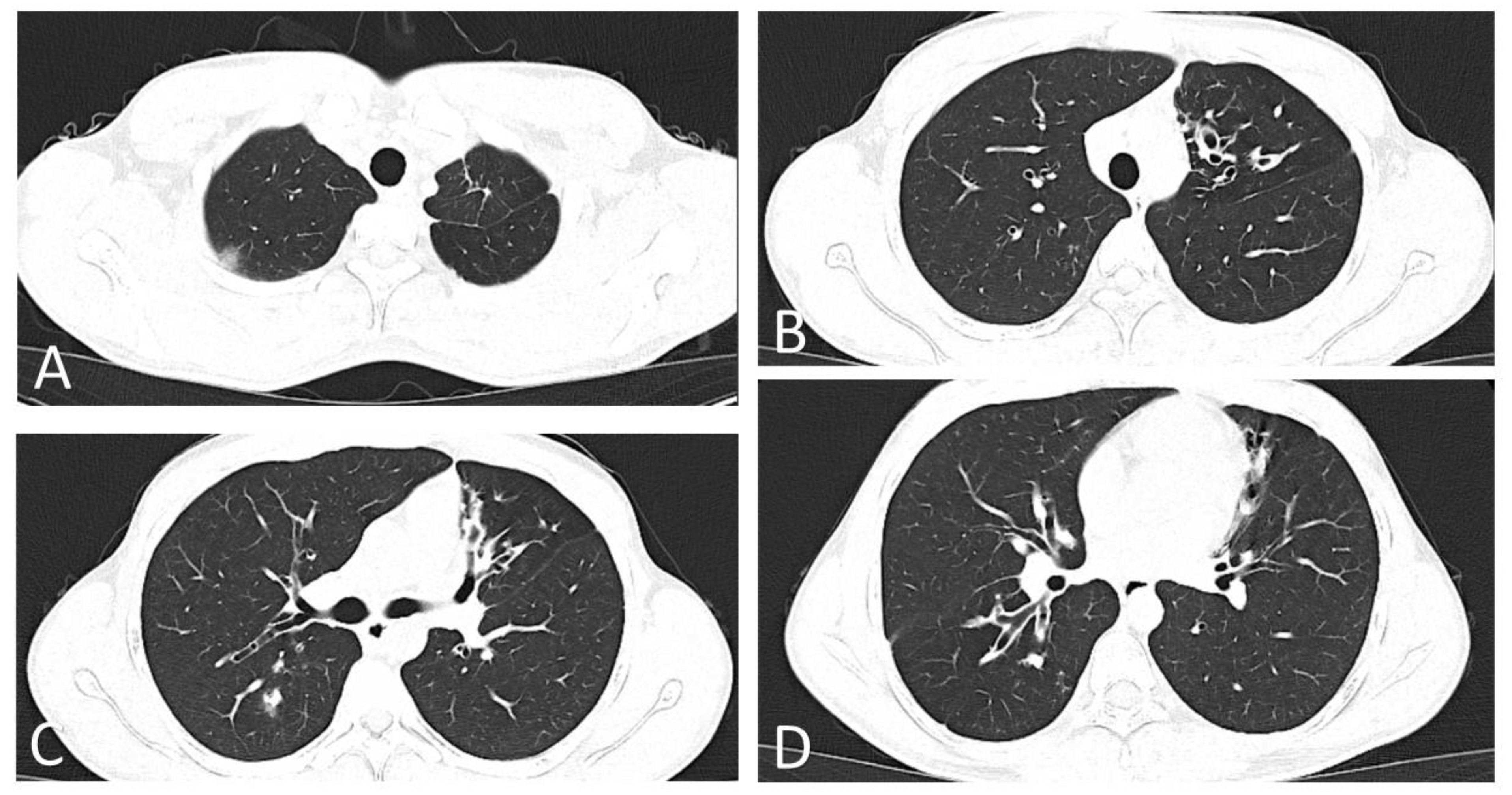 Diagnostics 12 00137 g002 550