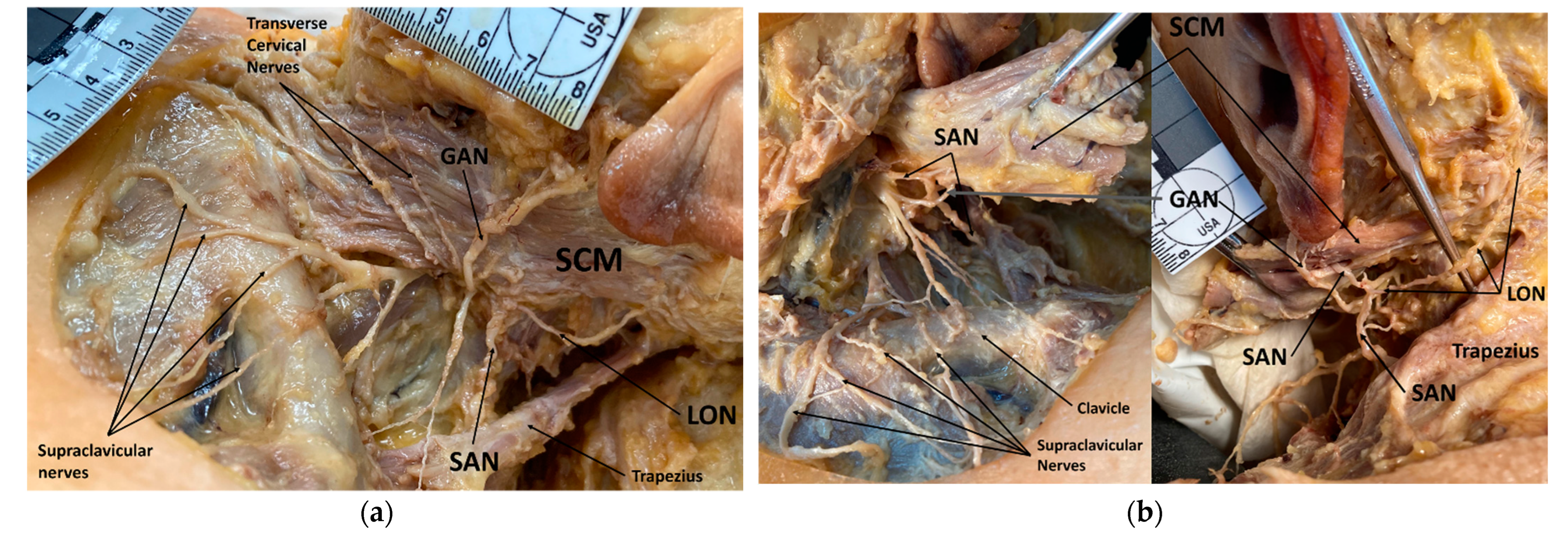 Diagnostics 12 00139 g003