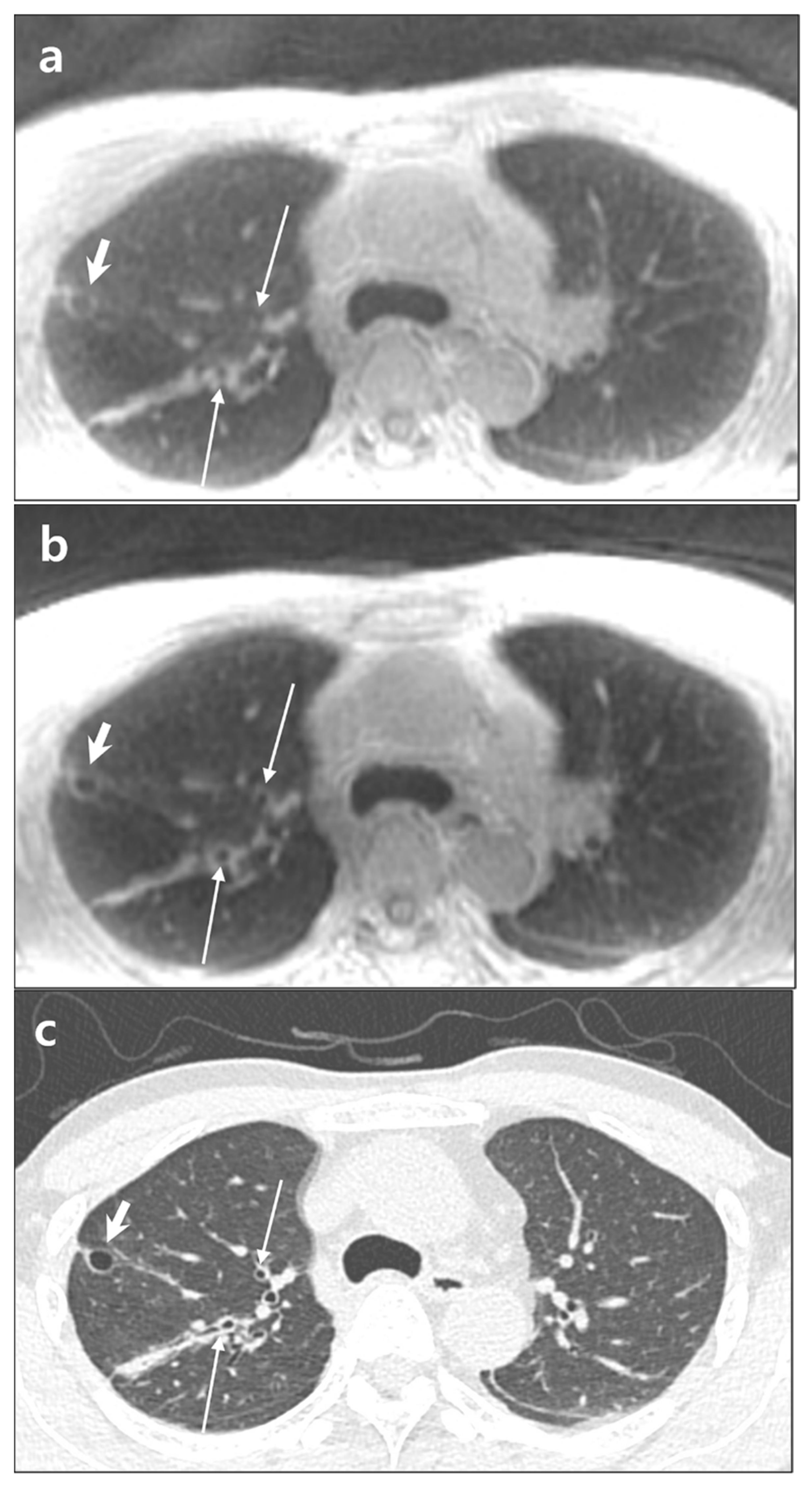 Diagnostics 12 00148 g002
