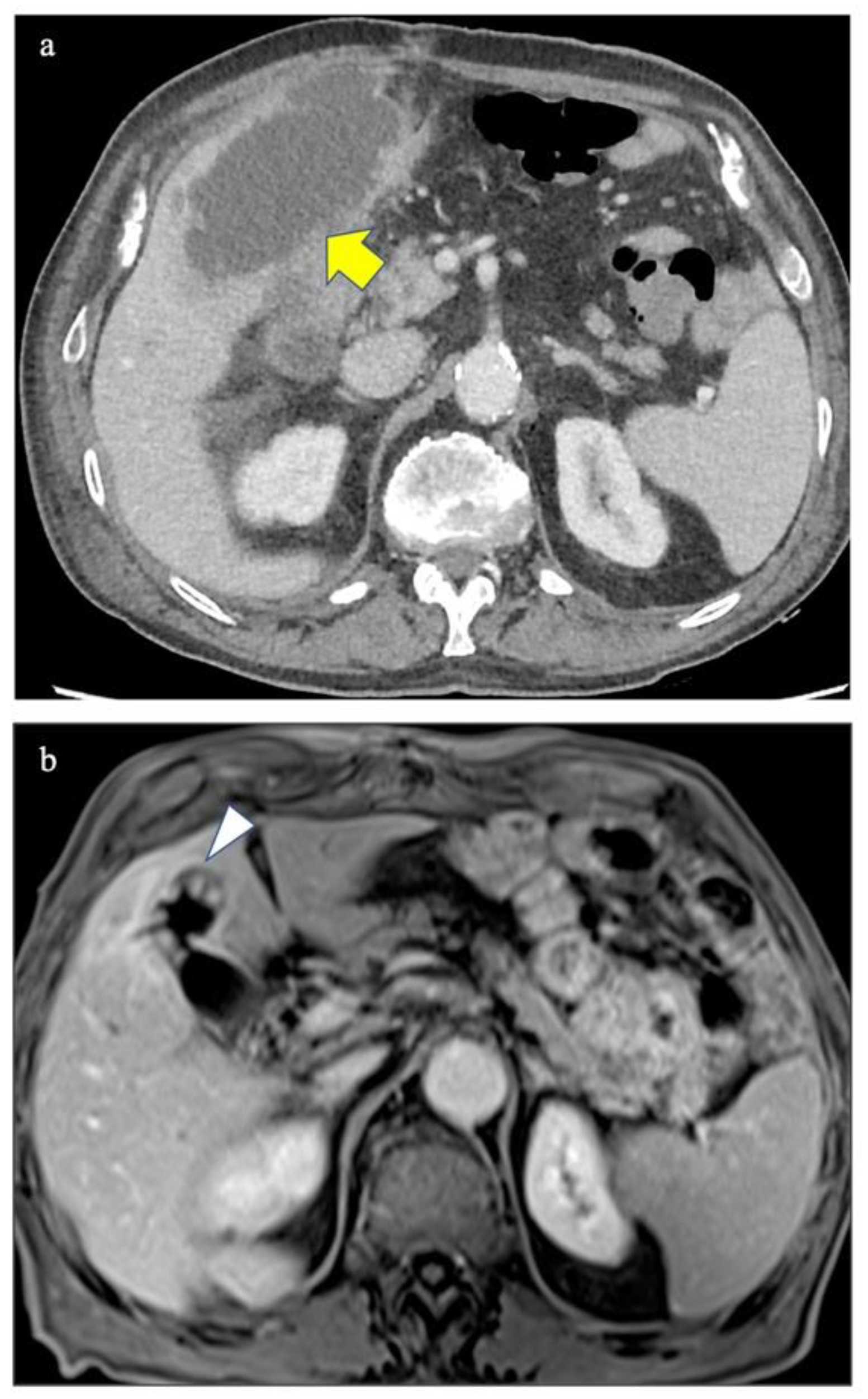 Diagnostics 12 00155 g001 550