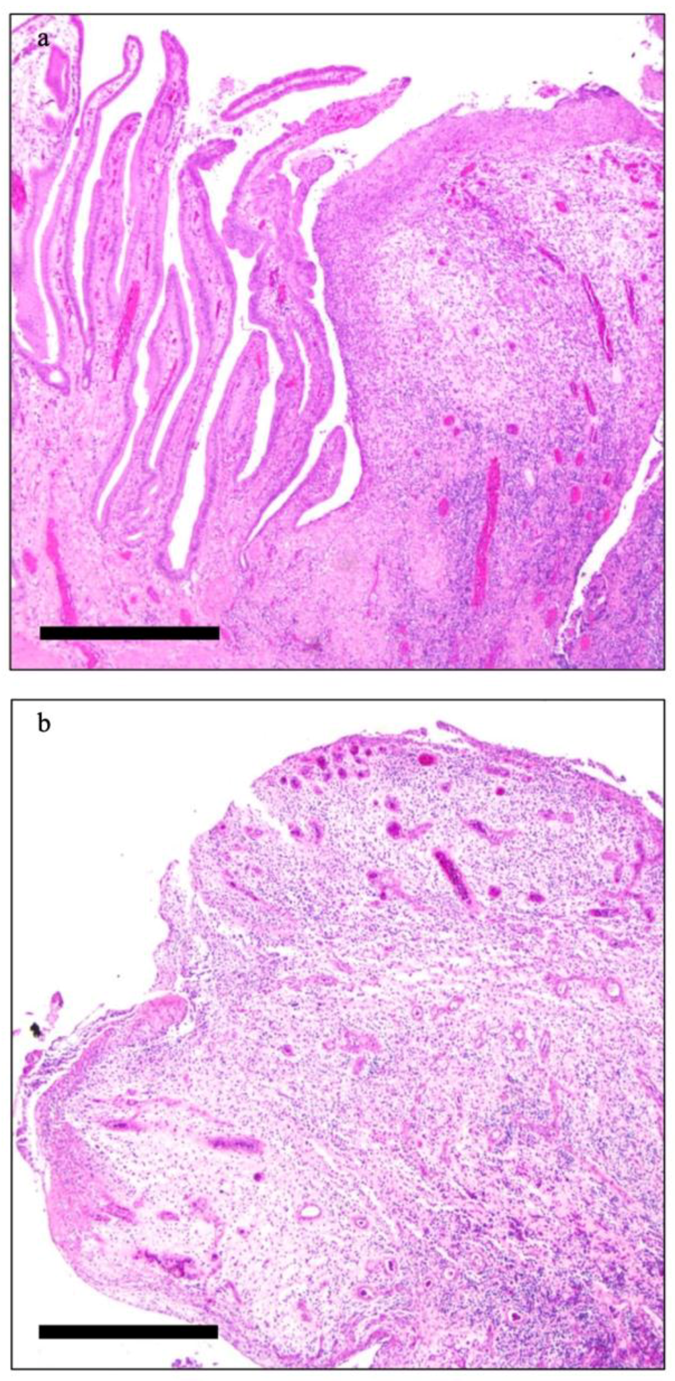Diagnostics 12 00155 g002 550