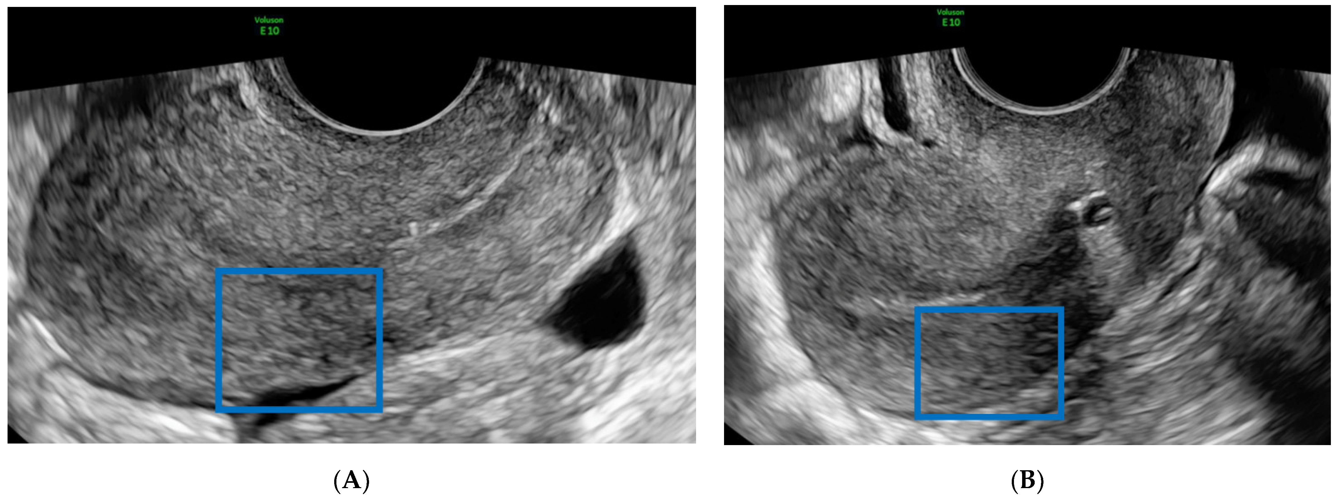 Diagnostics 12 00164 g001 550