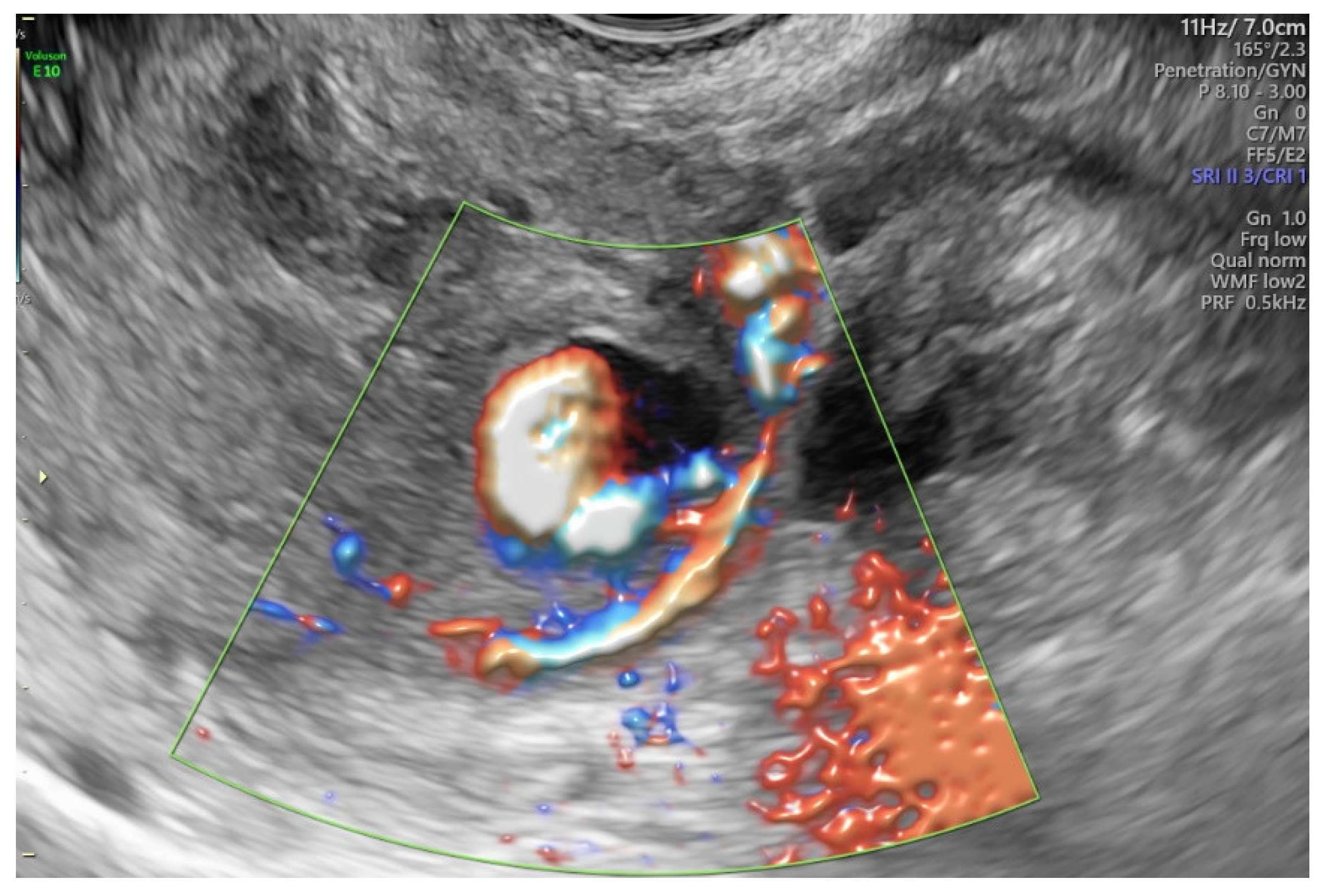 Diagnostics 12 00164 g002 550