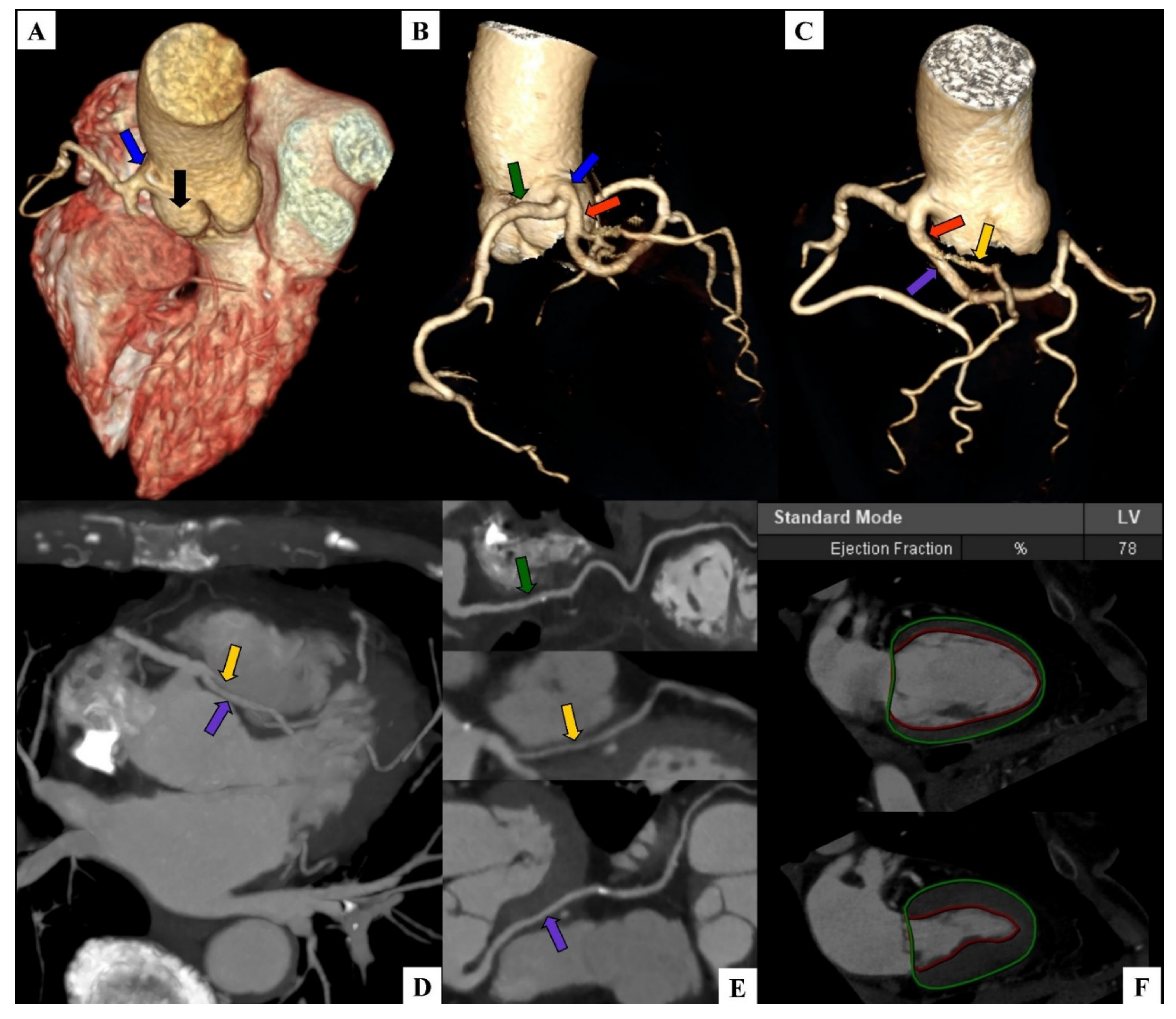 Diagnostics 12 00167 g001 Diagnostics 12 00167 g001