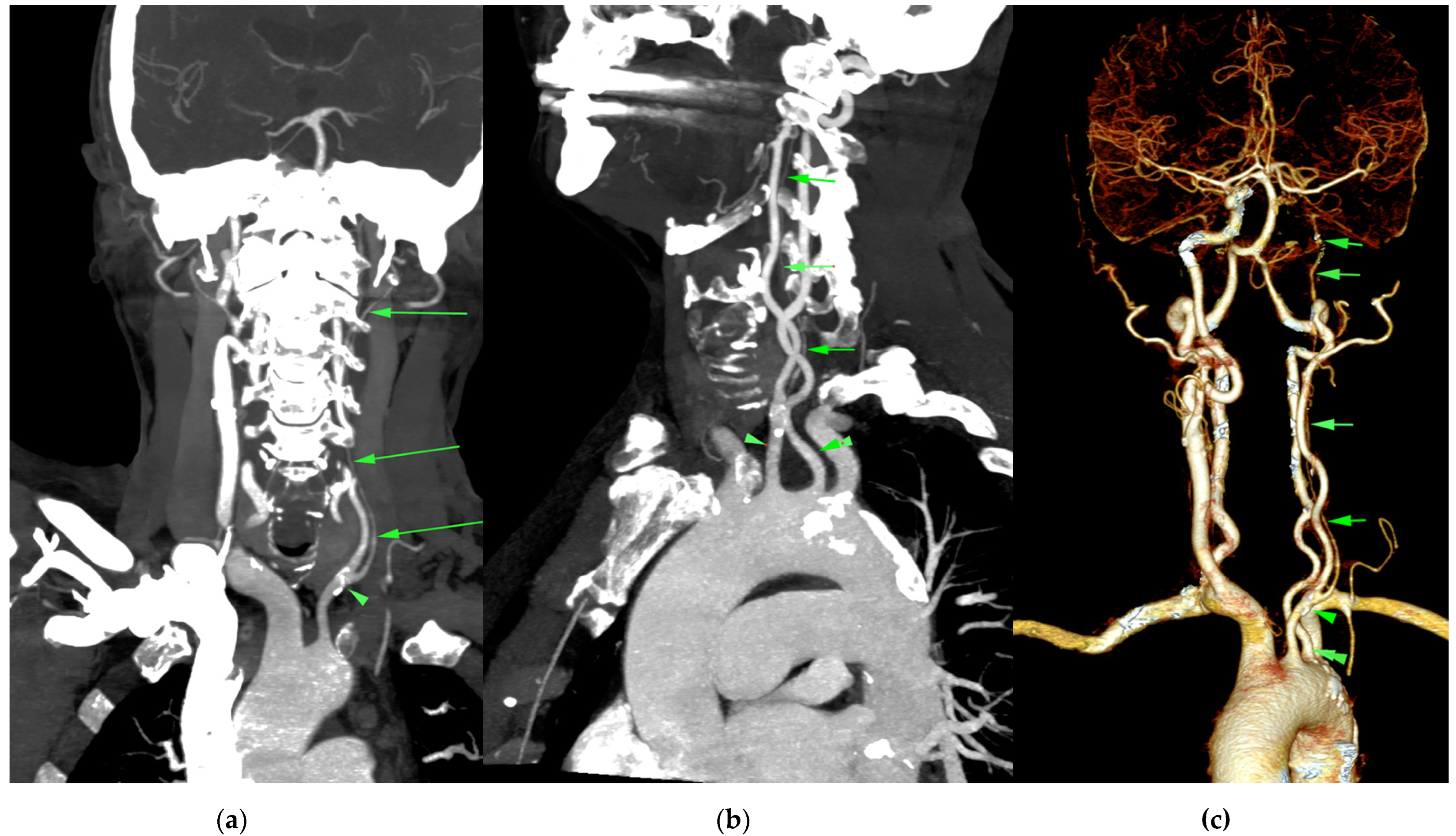 Diagnostics 12 00169 g001 550