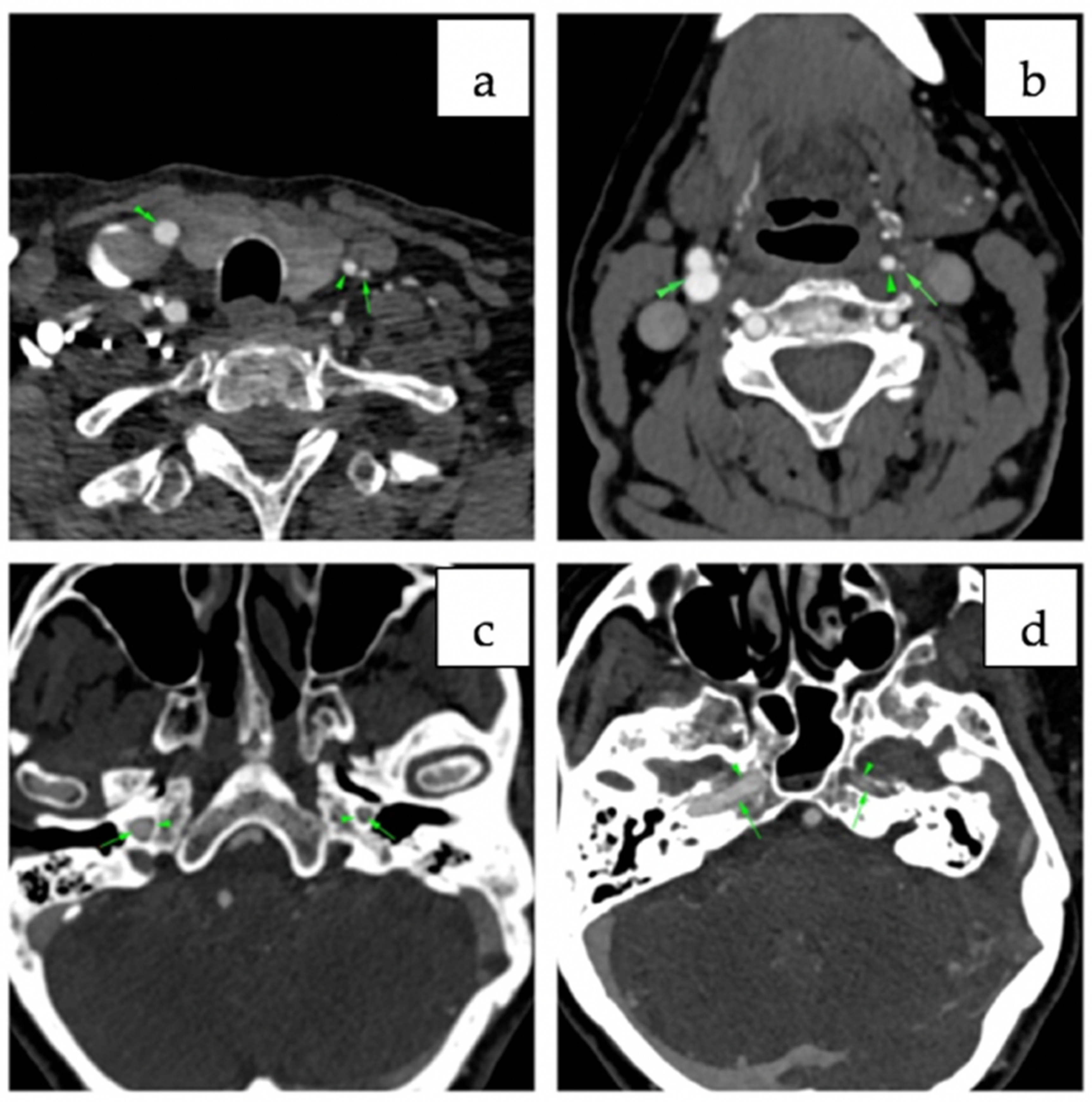Diagnostics 12 00169 g002 550
