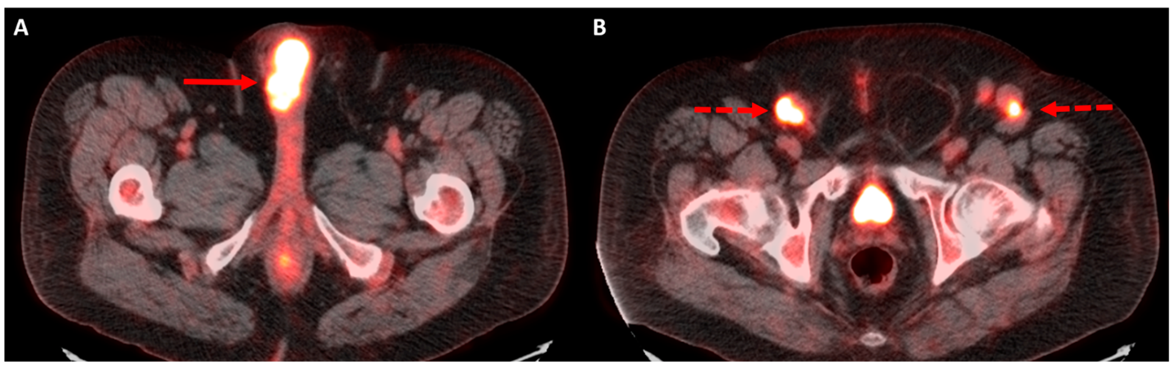 Diagnostics 12 00170 g003