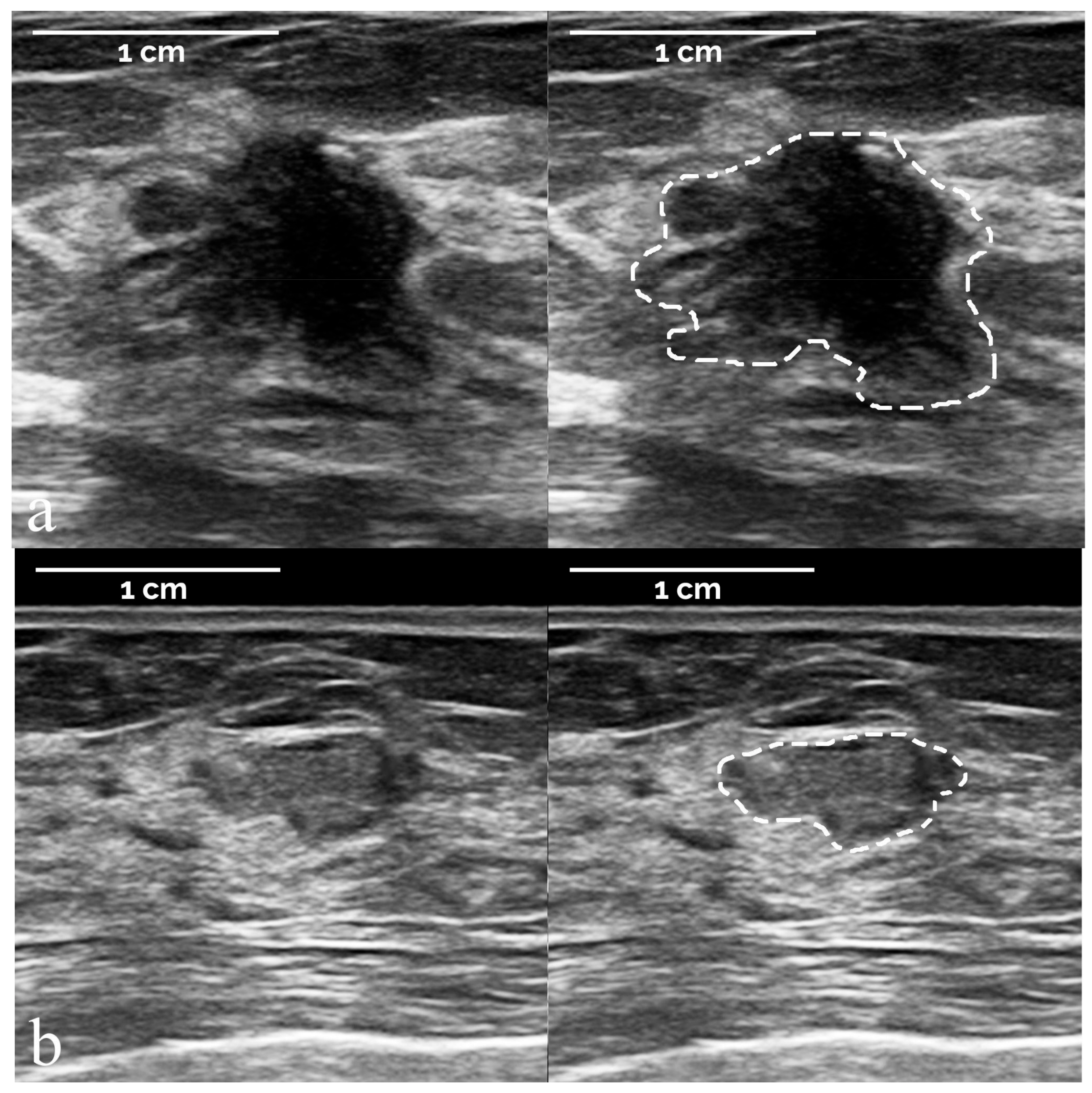 Diagnostics 12 00187 g004