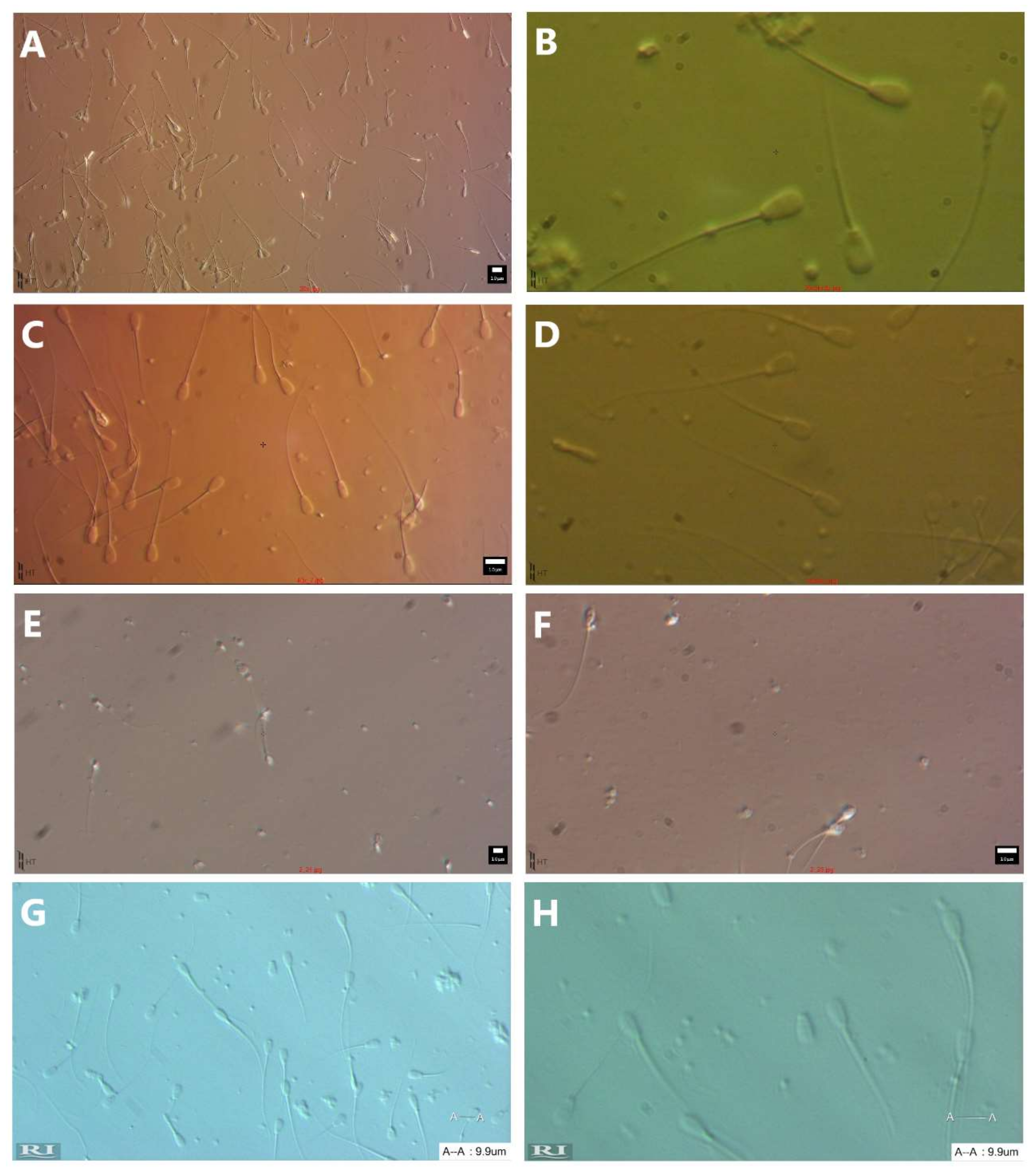 Diagnostics 12 00192 g0a4