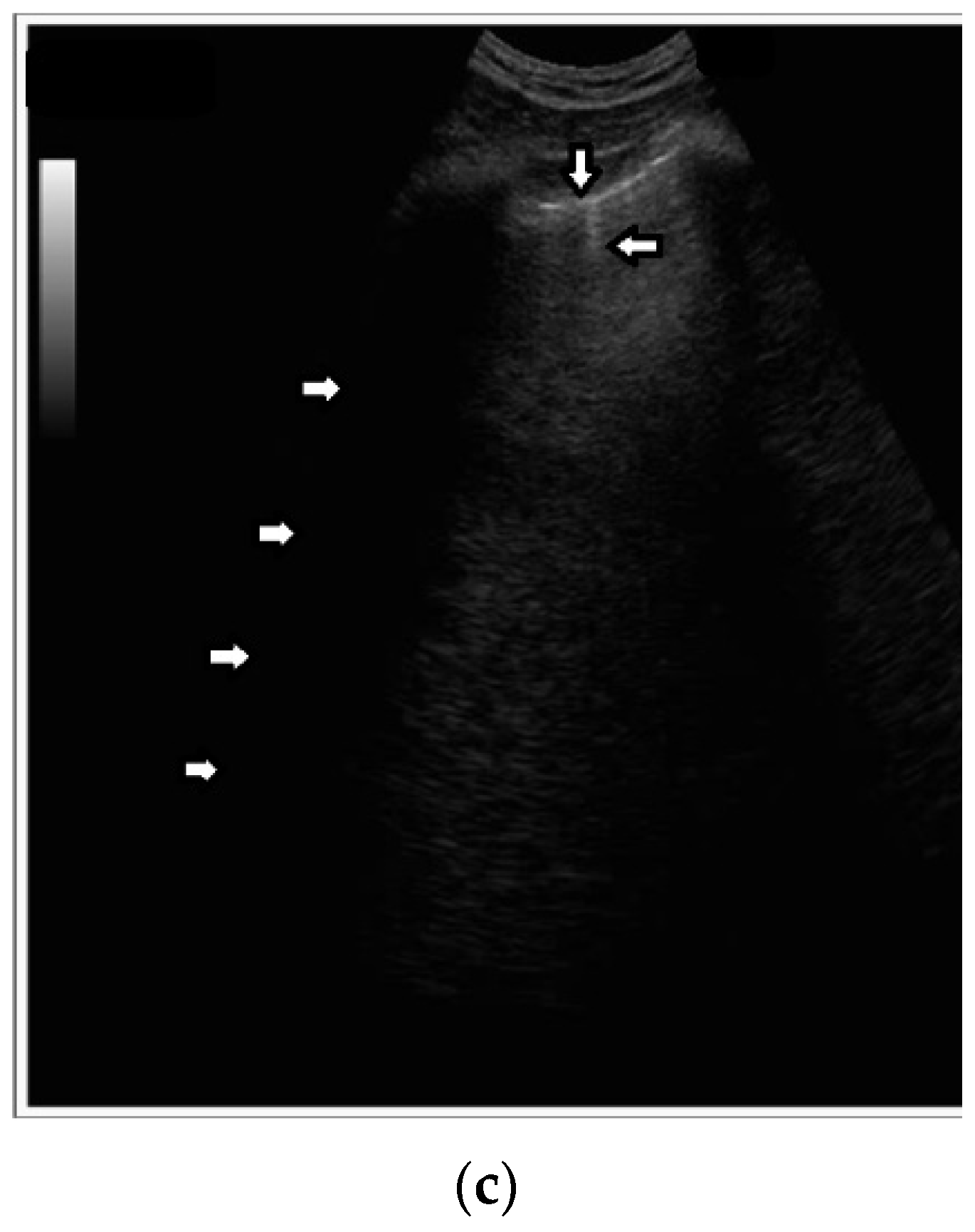 Diagnostics 12 00215 g005b 550