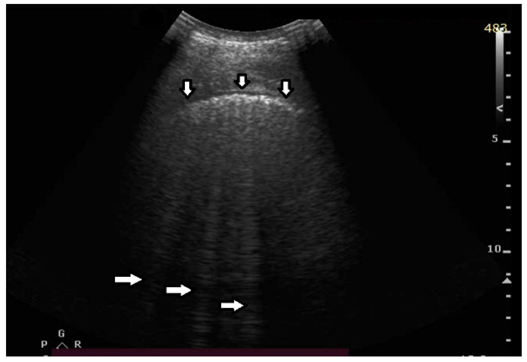 Diagnostics 12 00215 g006 550