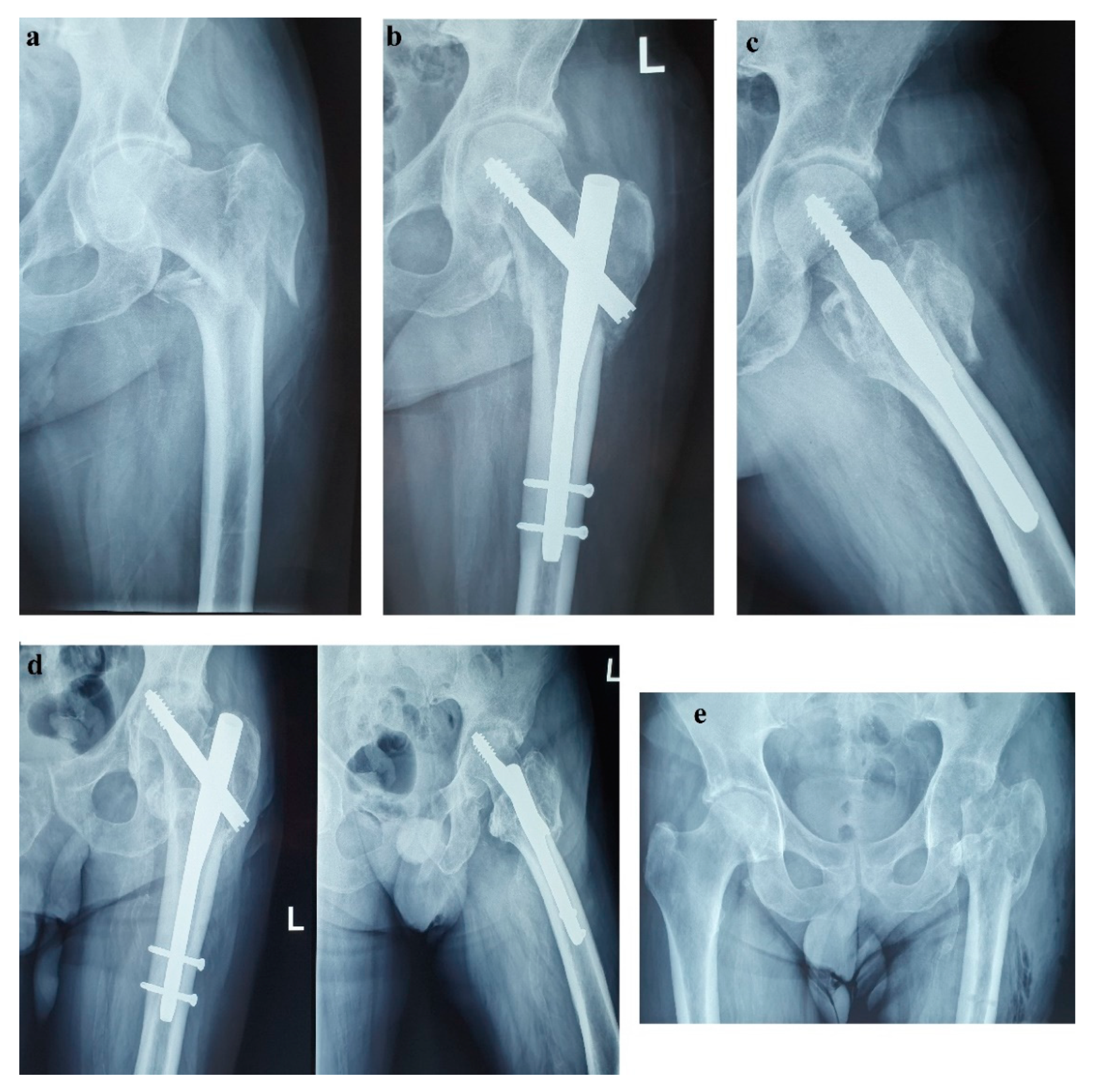 Diagnostics 12 00216 g002