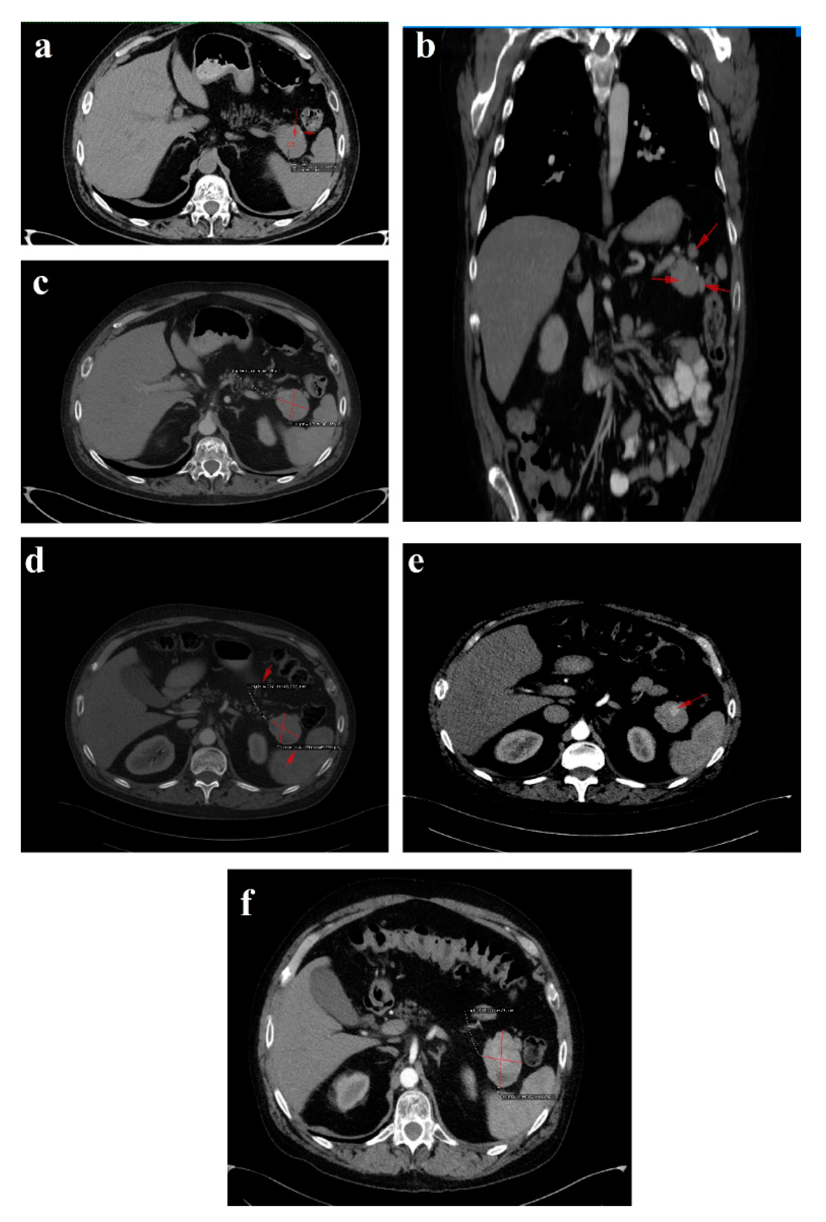 Diagnostics 12 00216 g003