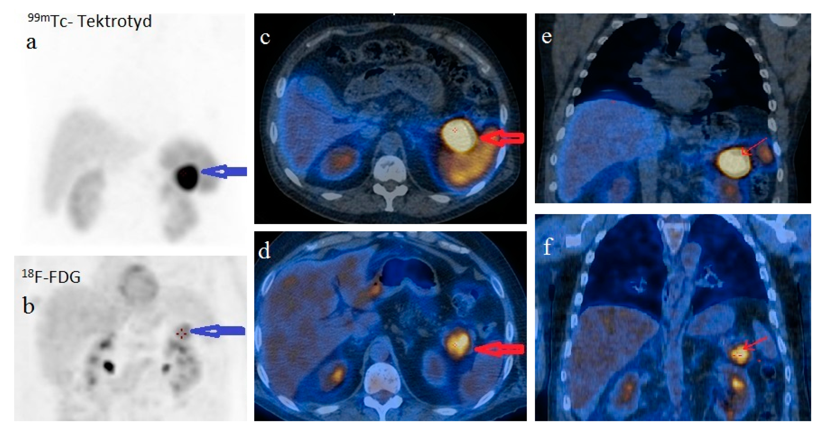 Diagnostics 12 00216 g005
