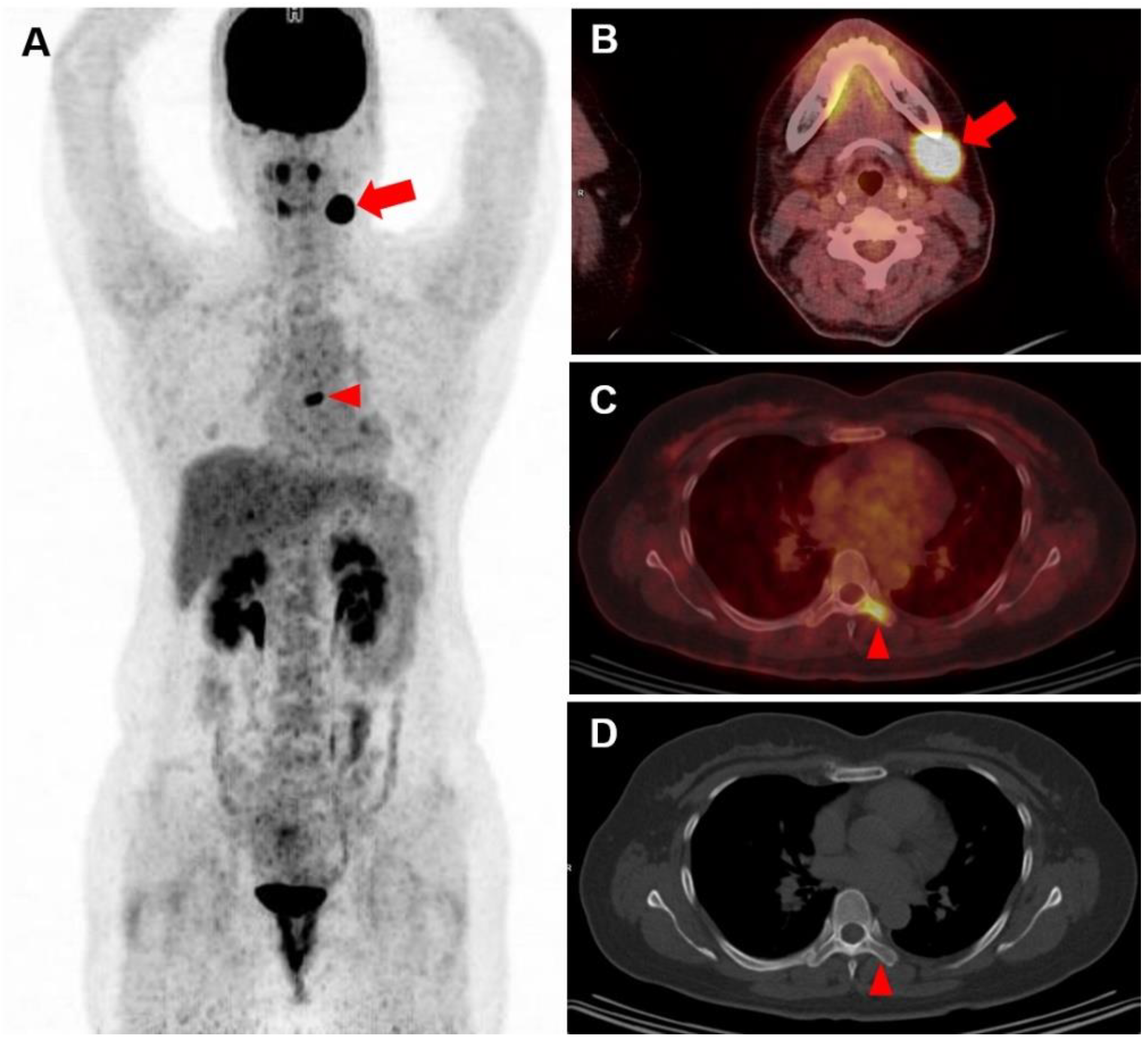 Diagnostics 12 00222 g002 550