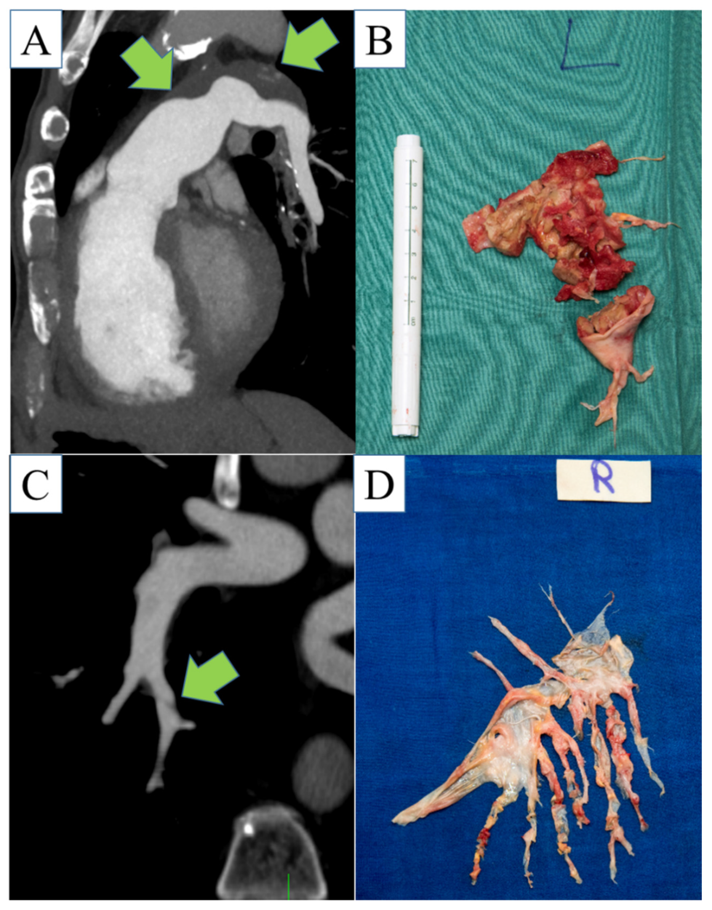 Diagnostics 12 00228 g002