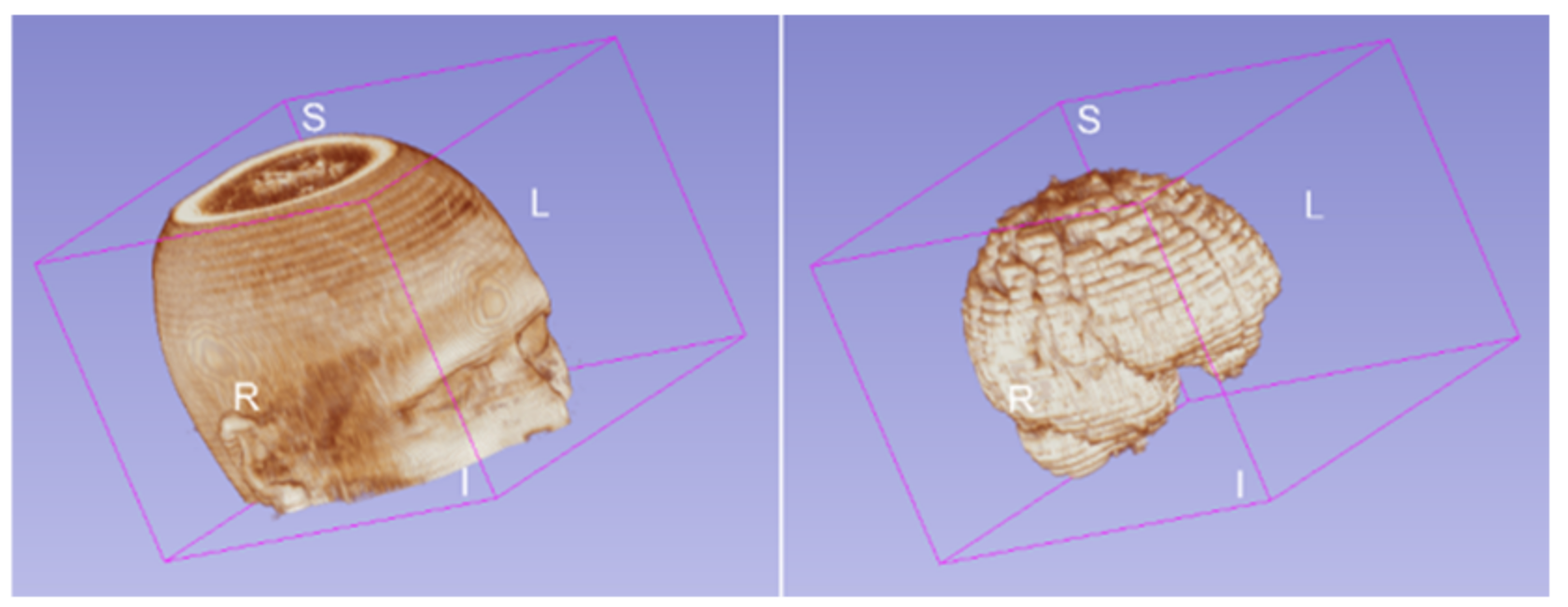 Diagnostics 12 00230 g007 550