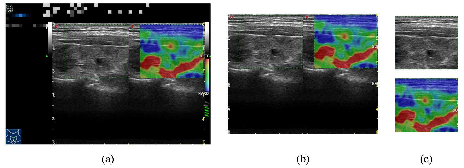Diagnostics 12 00253 g001