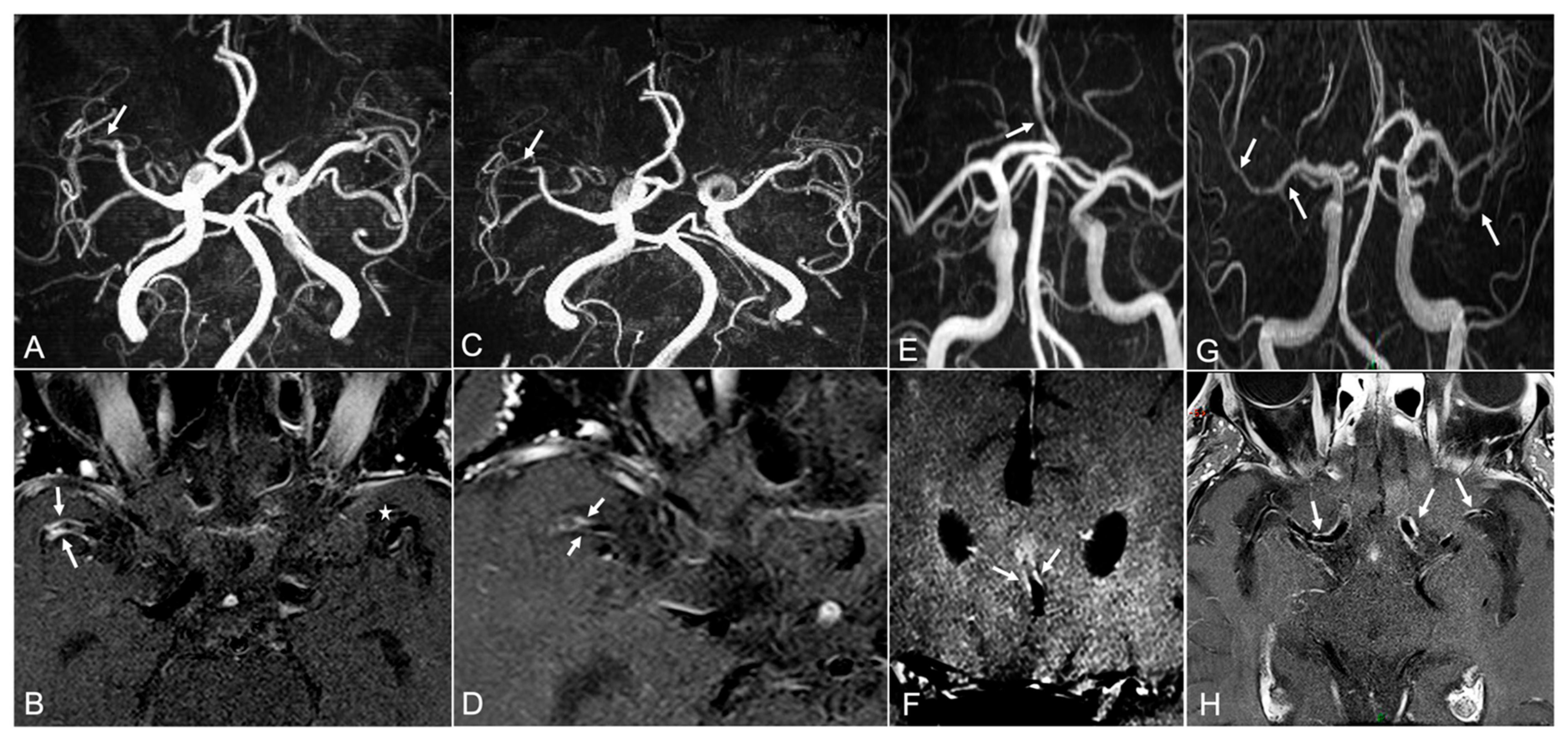 Diagnostics 12 00258 g001 550