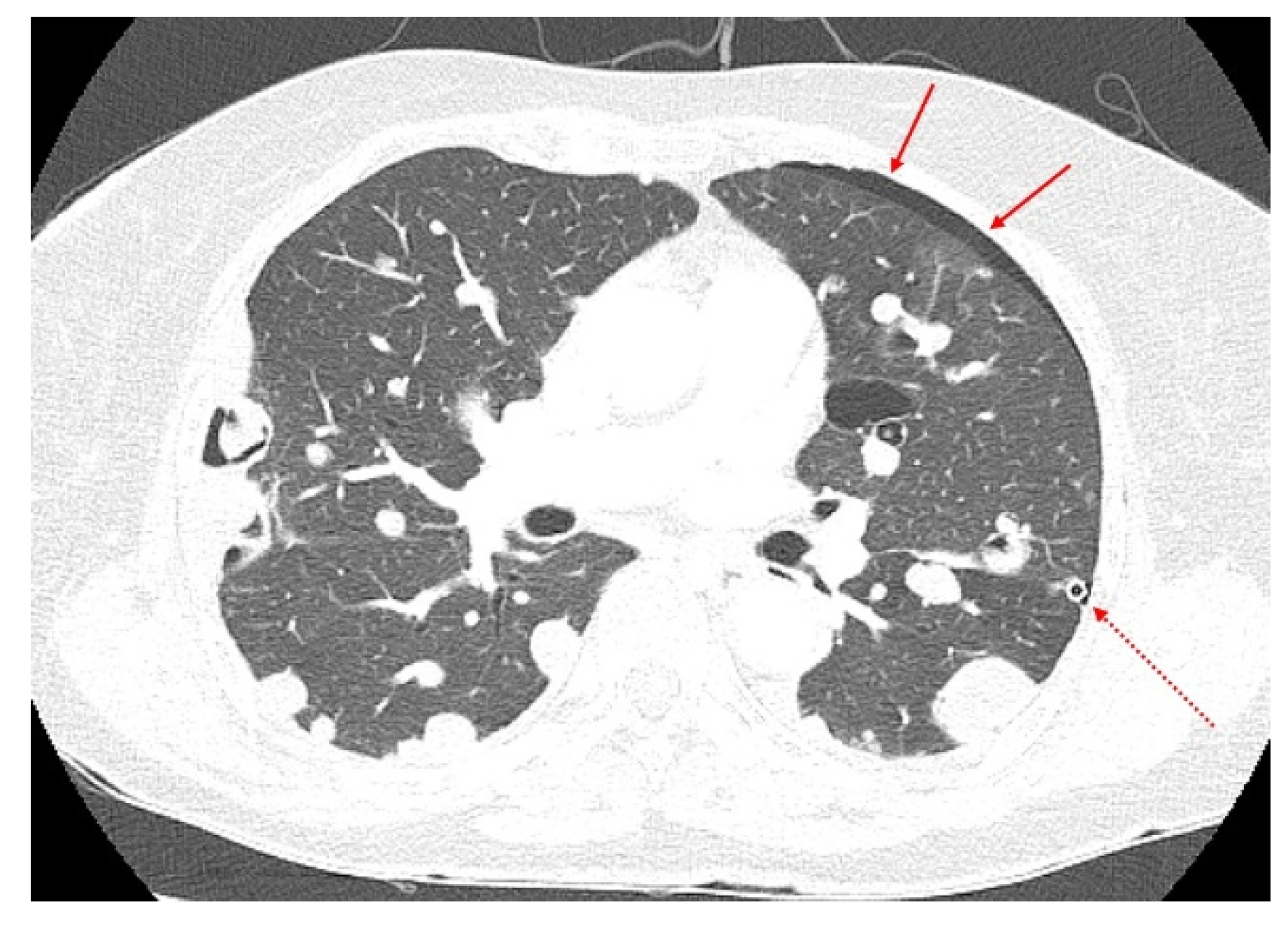 Diagnostics 12 00271 g001 550