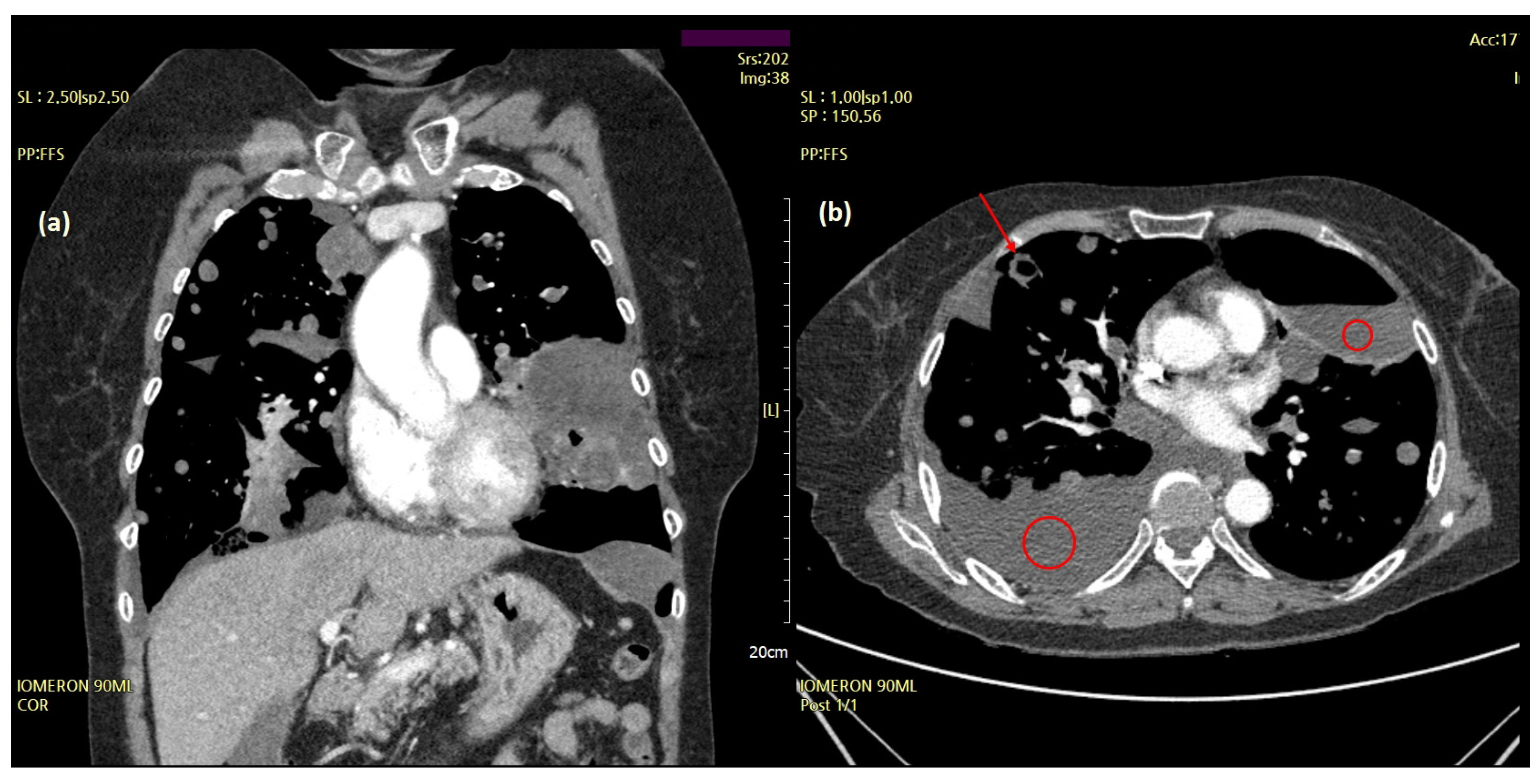 Diagnostics 12 00271 g002 550