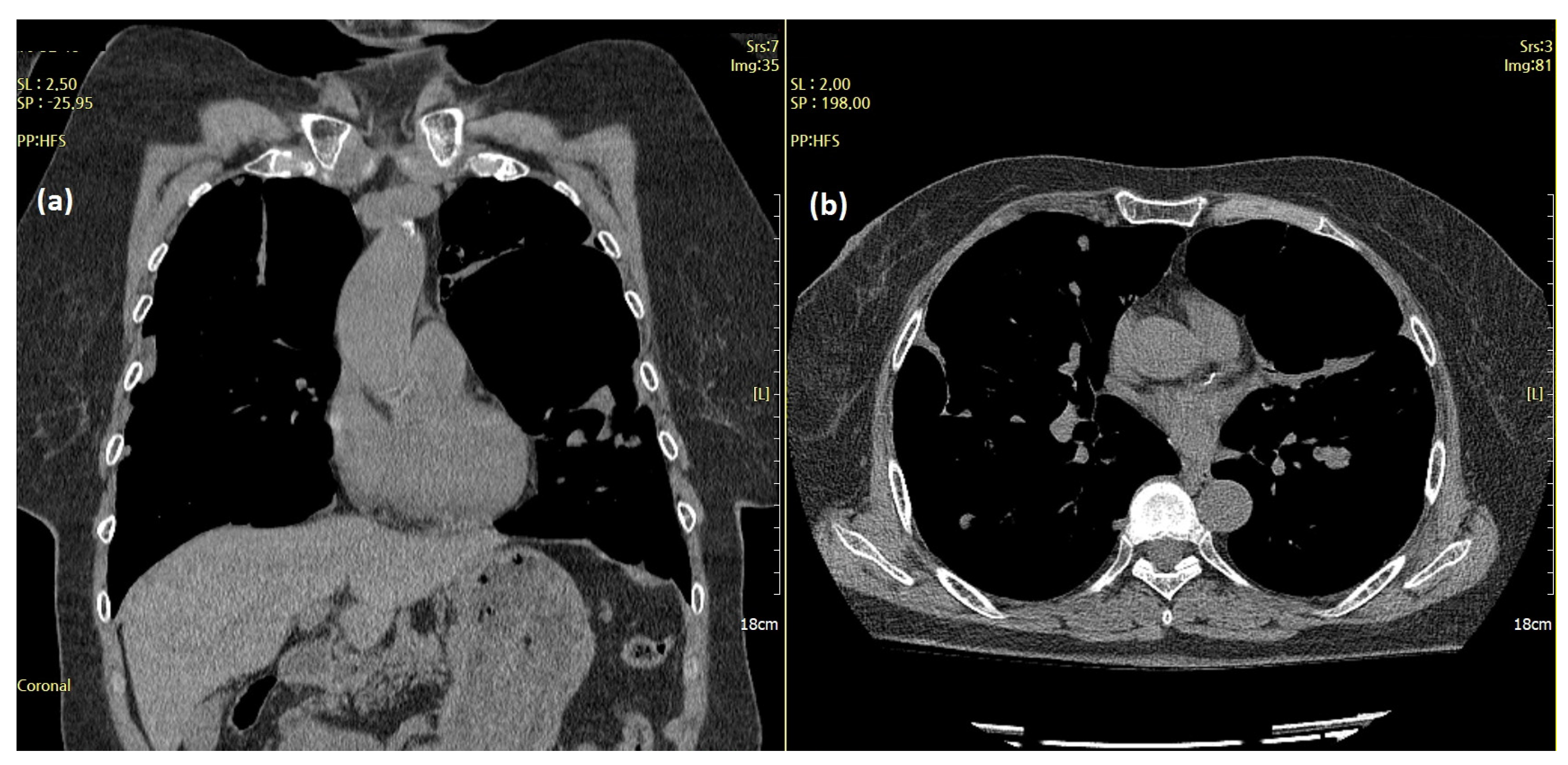 Diagnostics 12 00271 g005 550