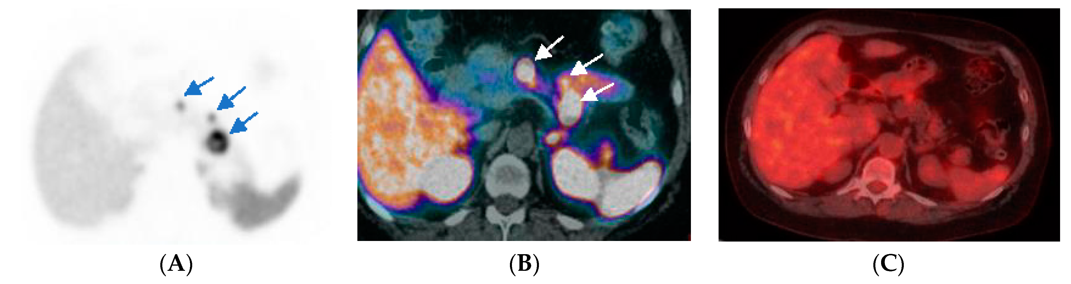 Diagnostics 12 00280 g002