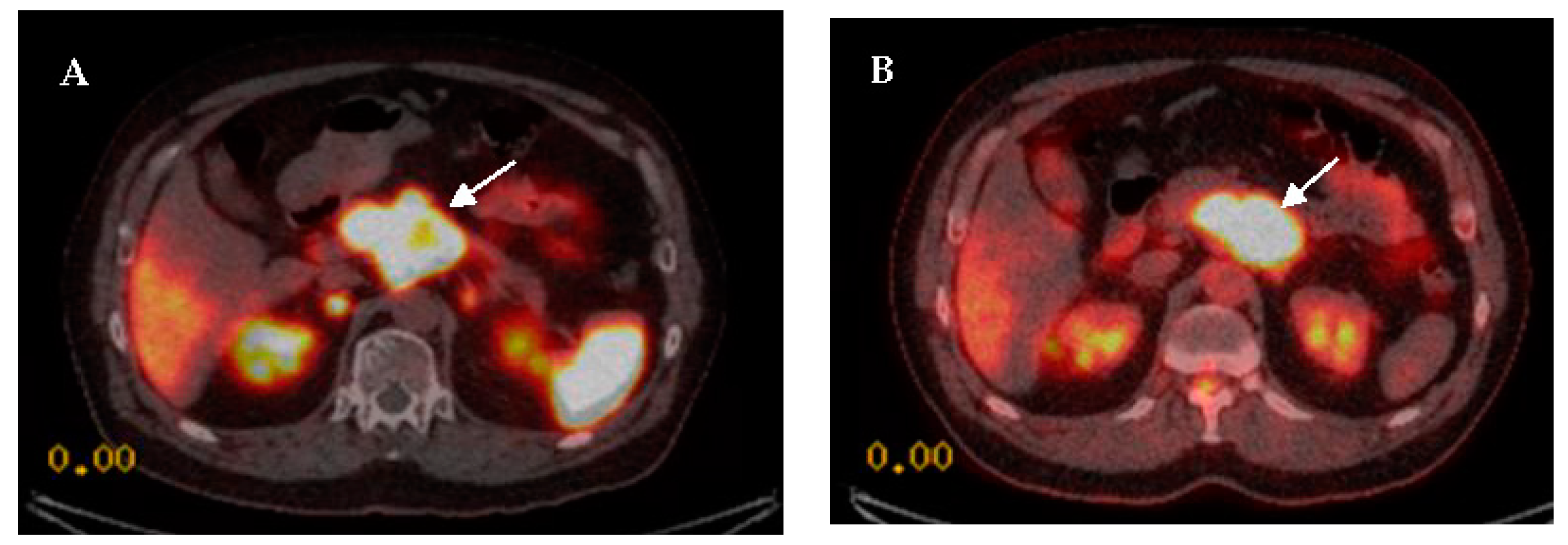 Diagnostics 12 00280 g003