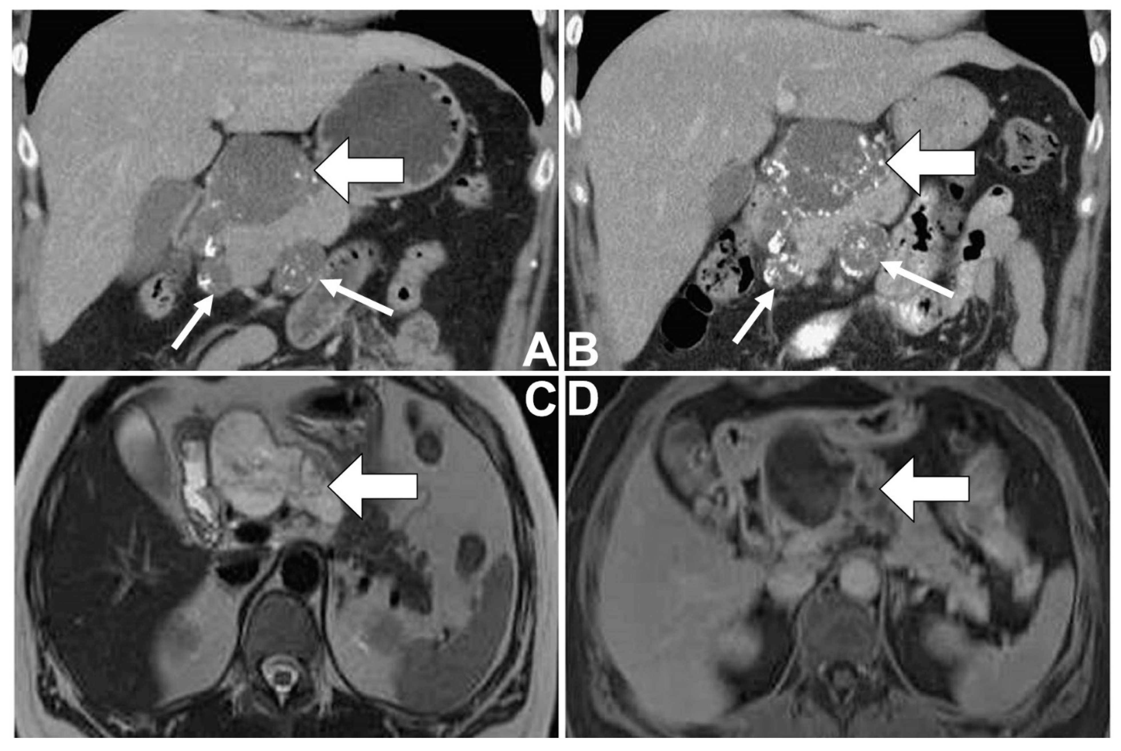 Diagnostics 12 00282 g001