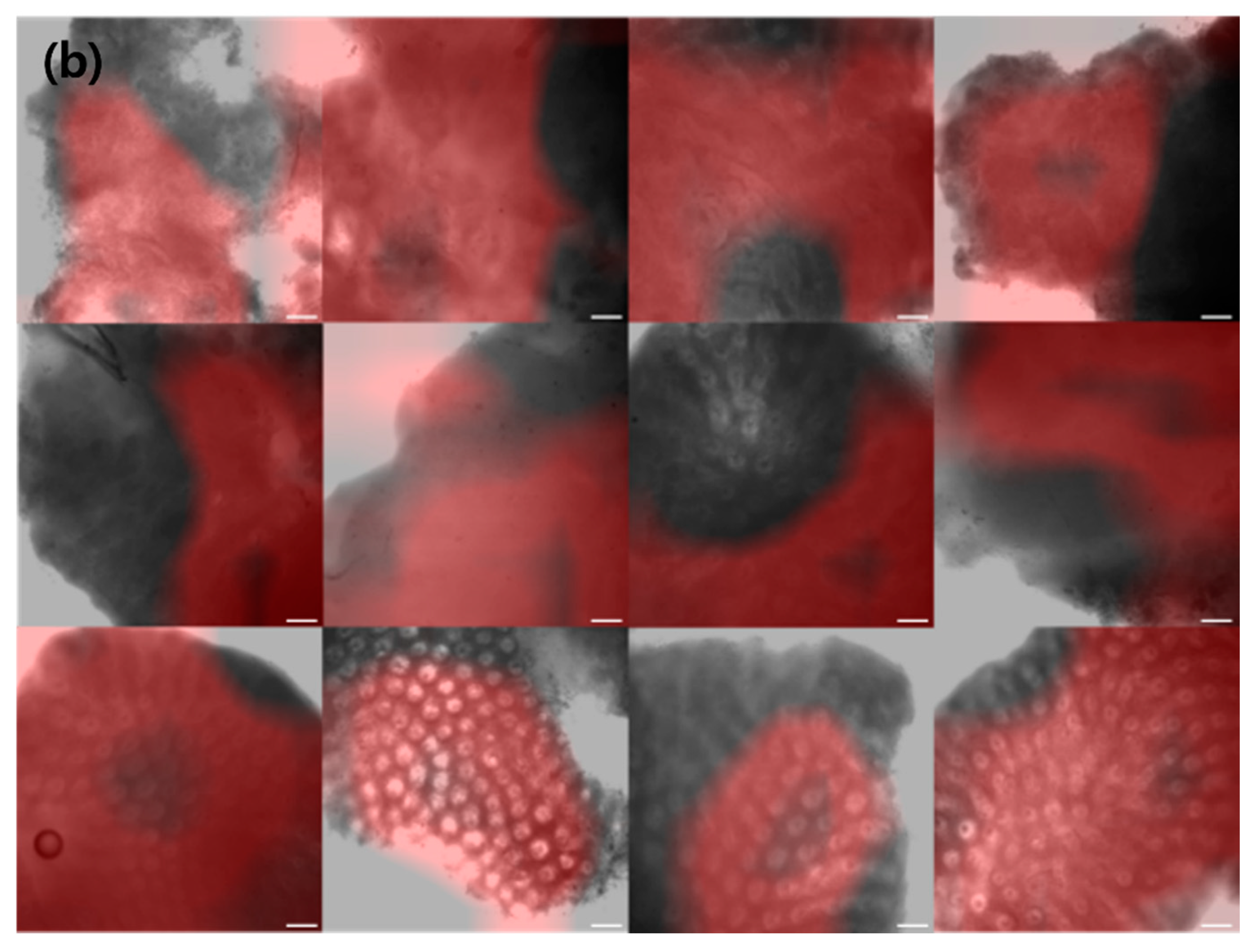 Diagnostics 12 00288 g002b 550