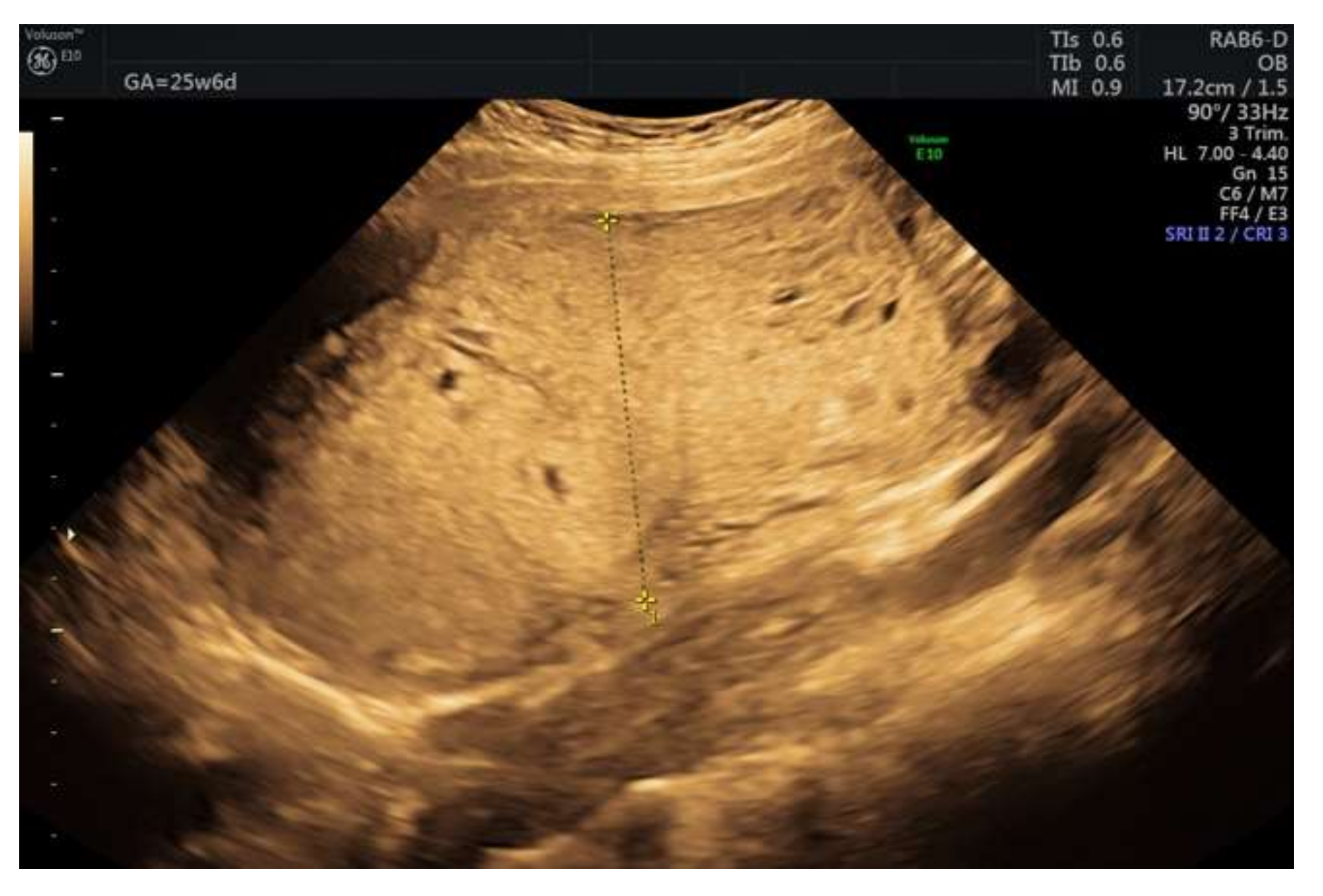 Diagnostics 12 00293 g002 Diagnostics 12 00293 g002