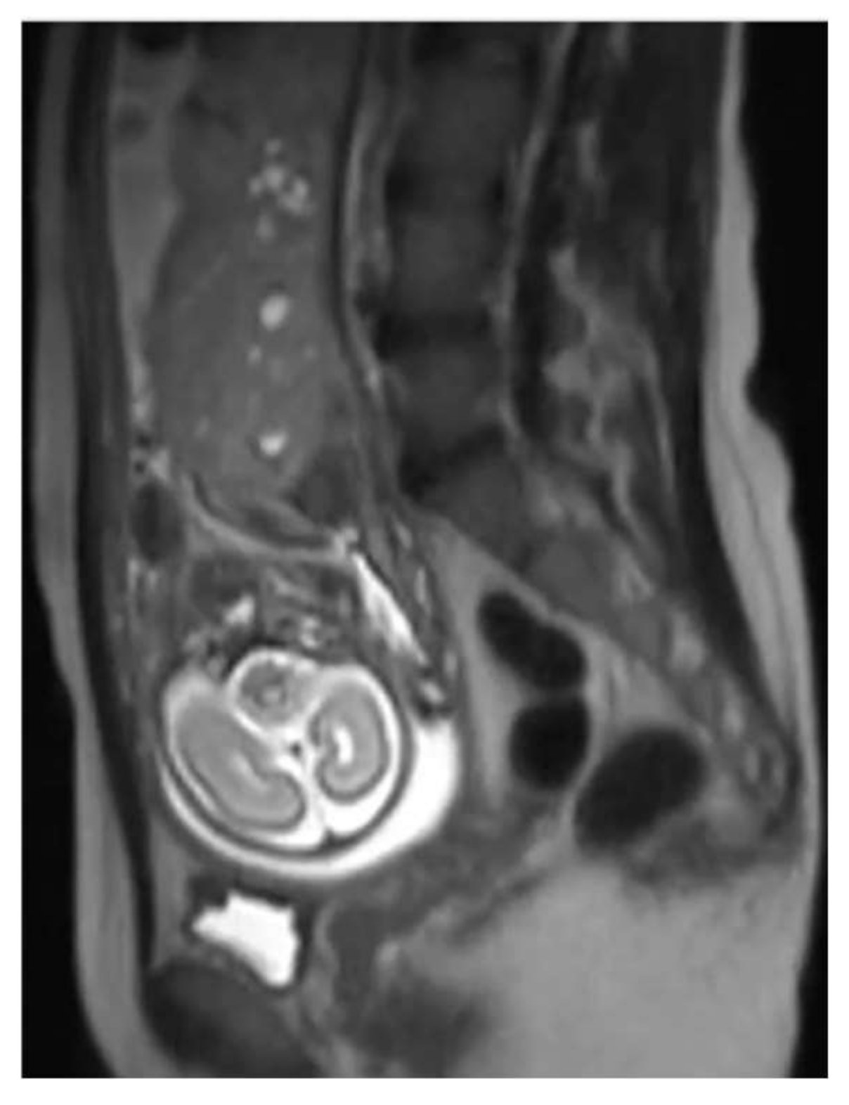 Diagnostics 12 00293 g003 Diagnostics 12 00293 g003