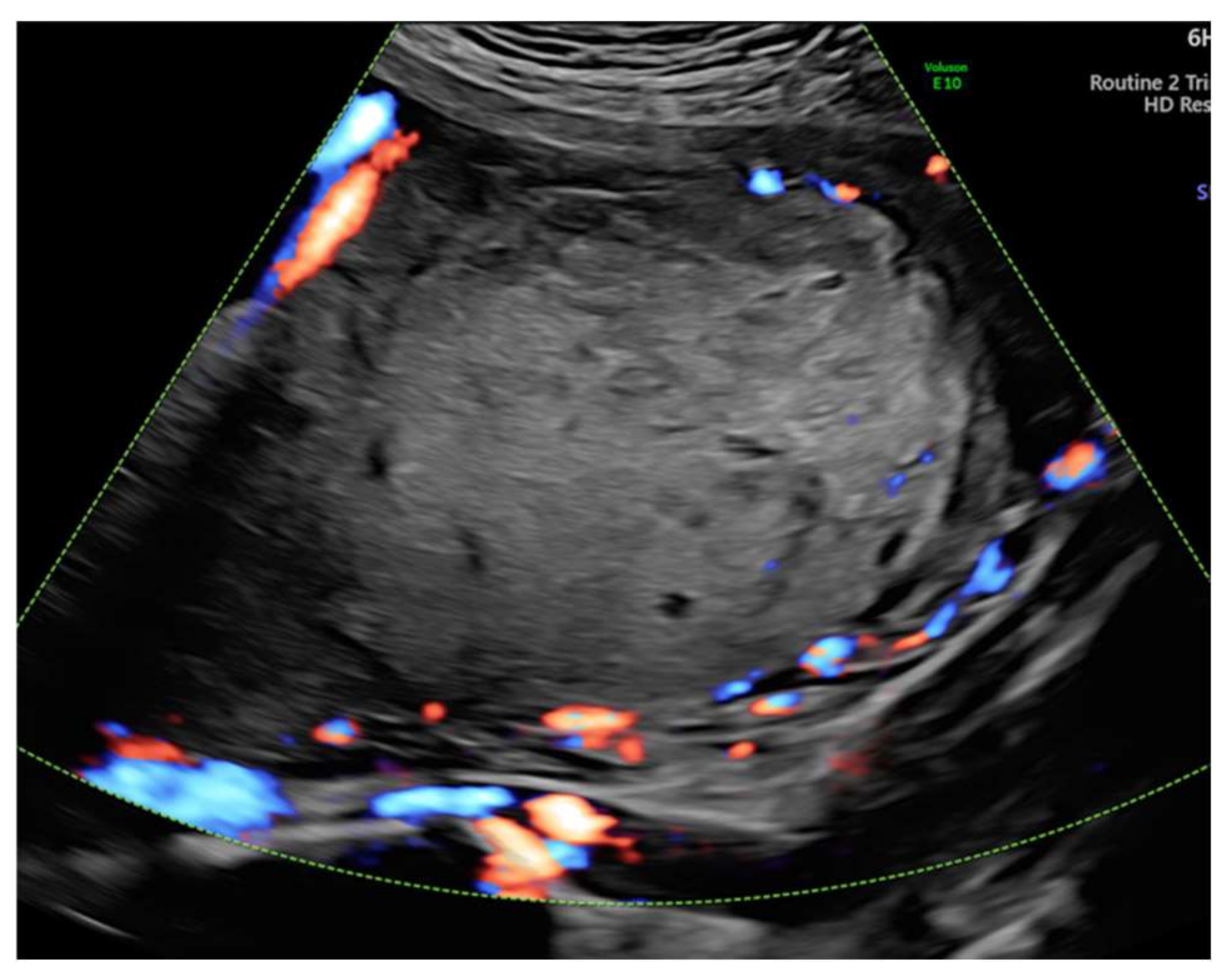 Diagnostics 12 00293 g004 Diagnostics 12 00293 g004