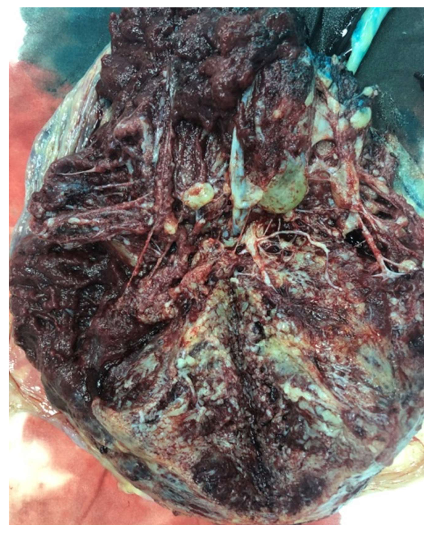 Diagnostics 12 00293 g005 Diagnostics 12 00293 g005