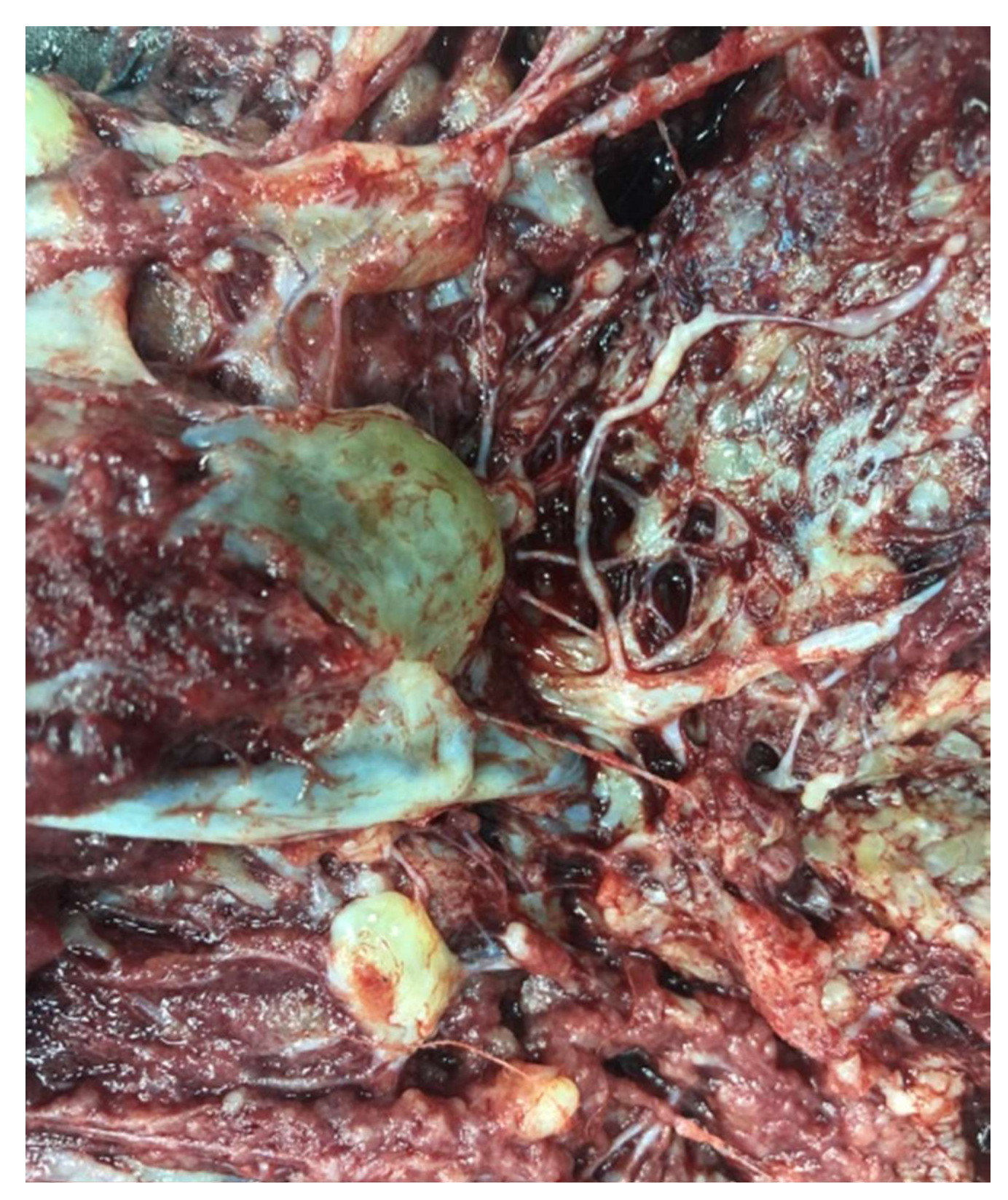 Diagnostics 12 00293 g006 Diagnostics 12 00293 g006