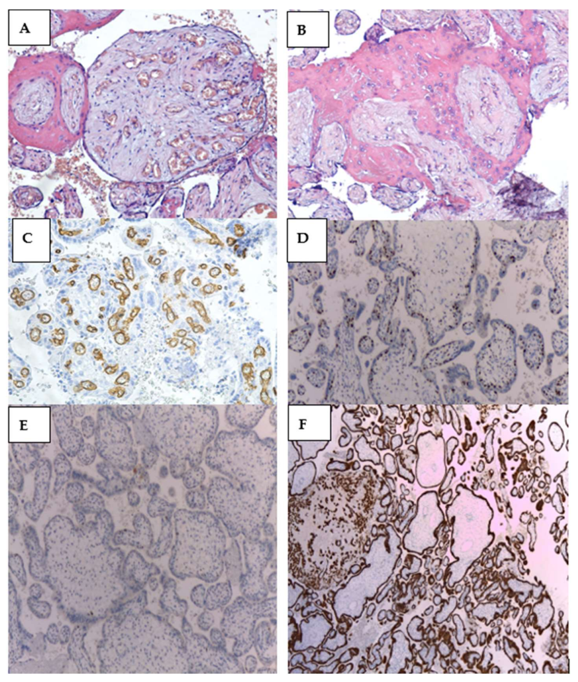 Diagnostics 12 00293 g007 Diagnostics 12 00293 g007