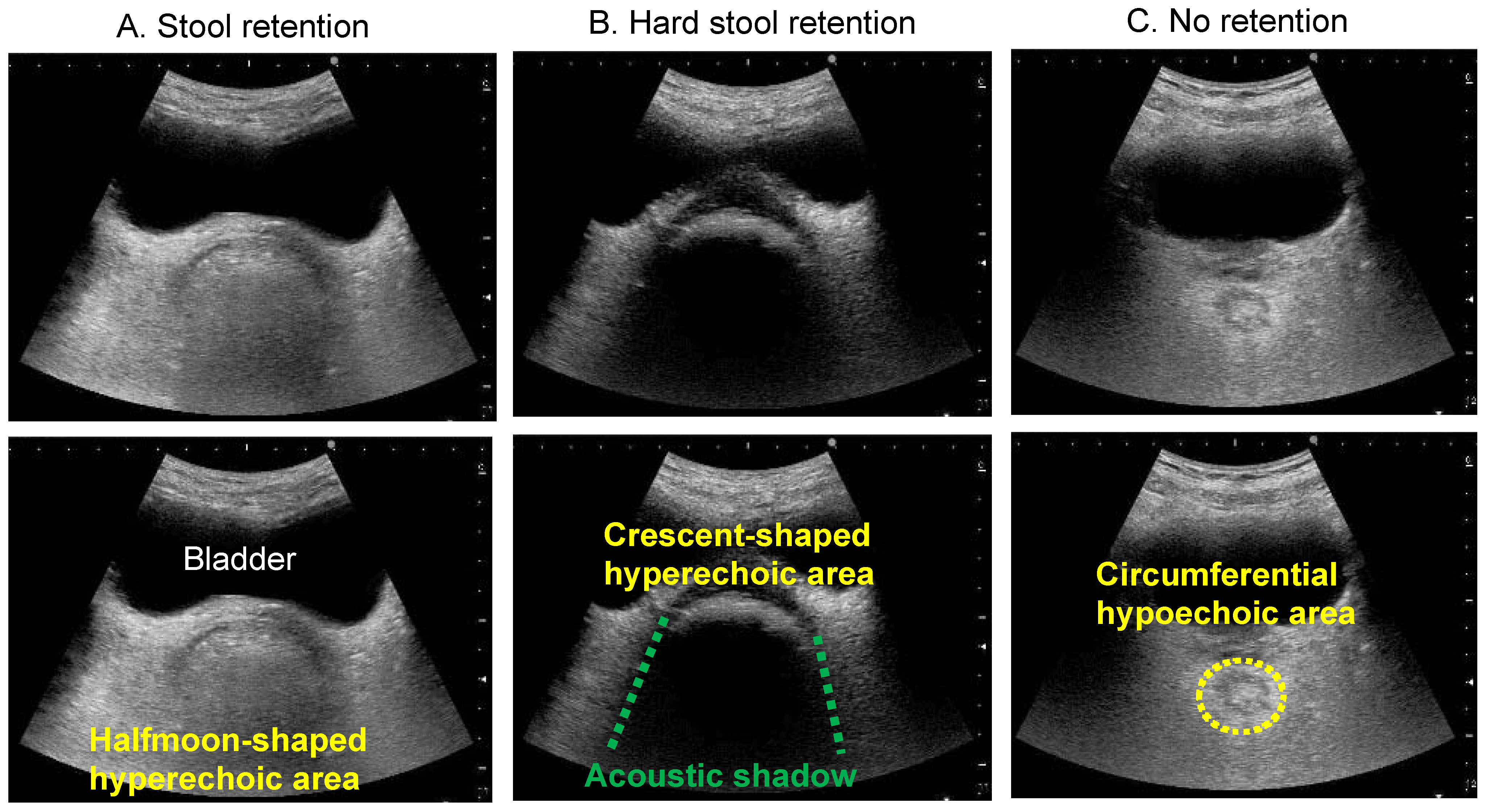 Diagnostics 12 00300 g003