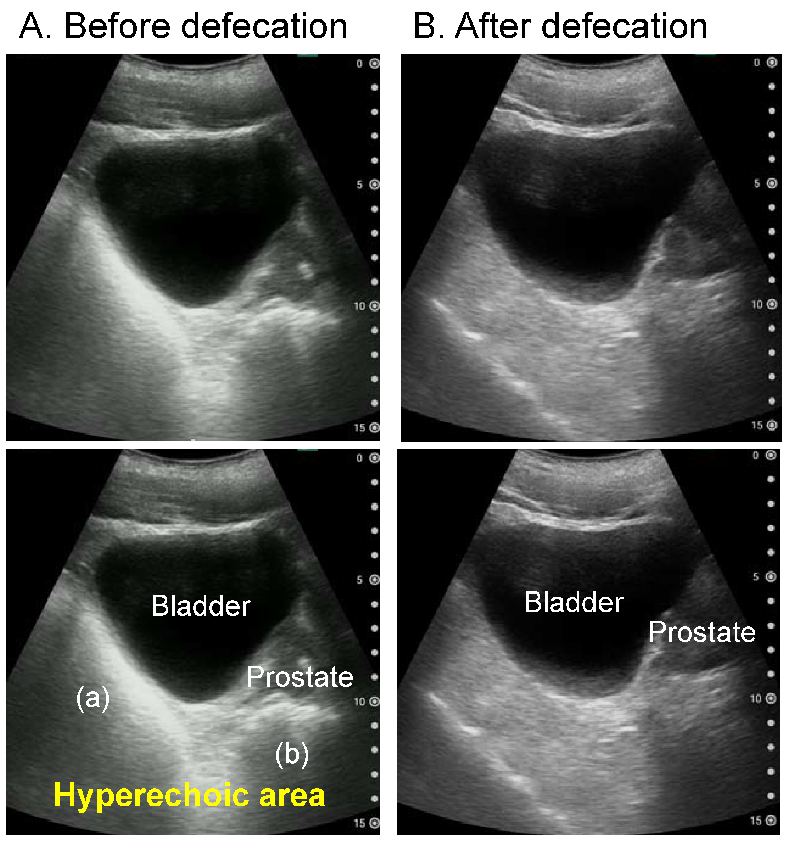 Diagnostics Free FullText Expert Consensus Document Diagnosis for