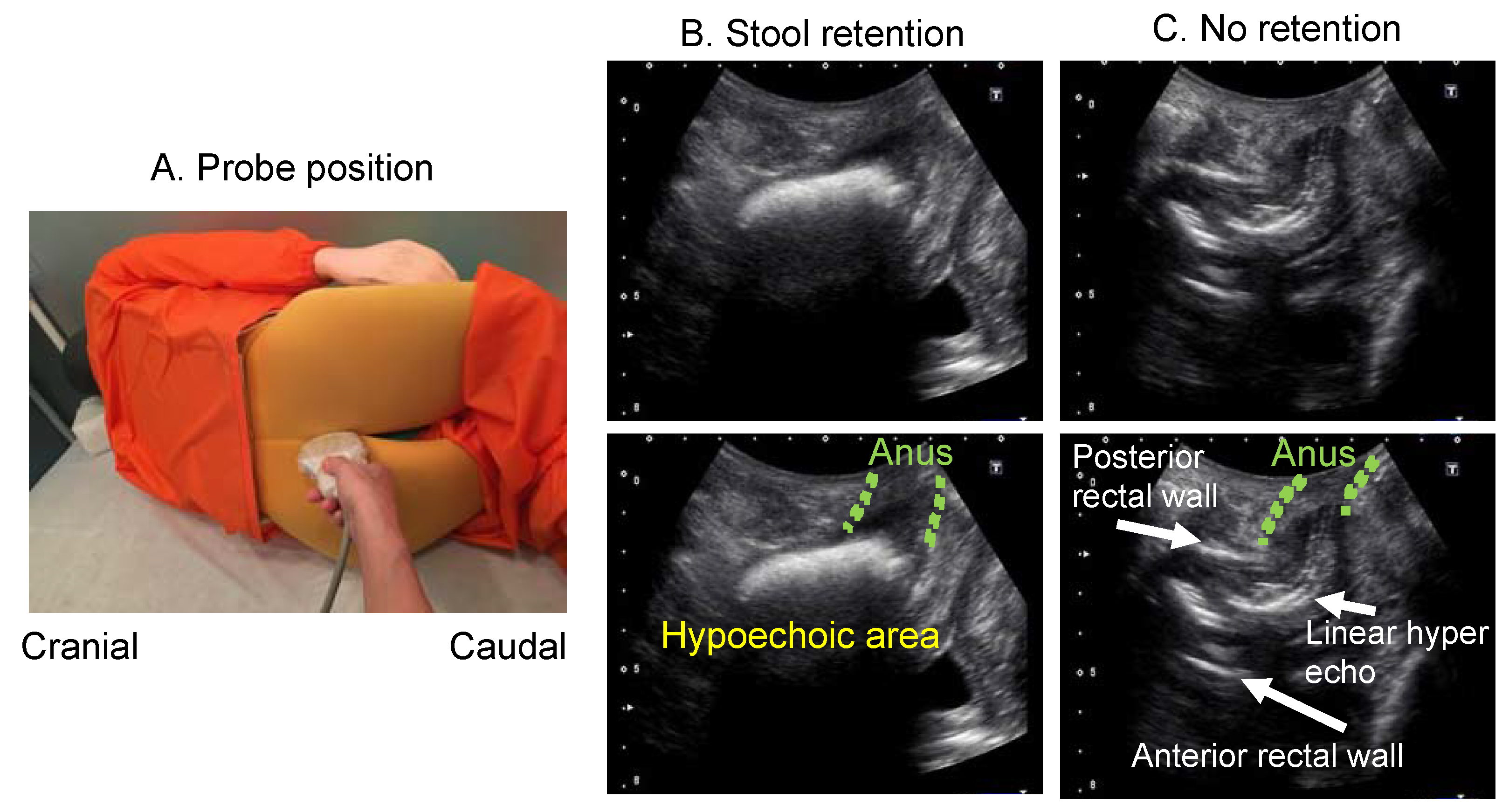 Diagnostics 12 00300 g007