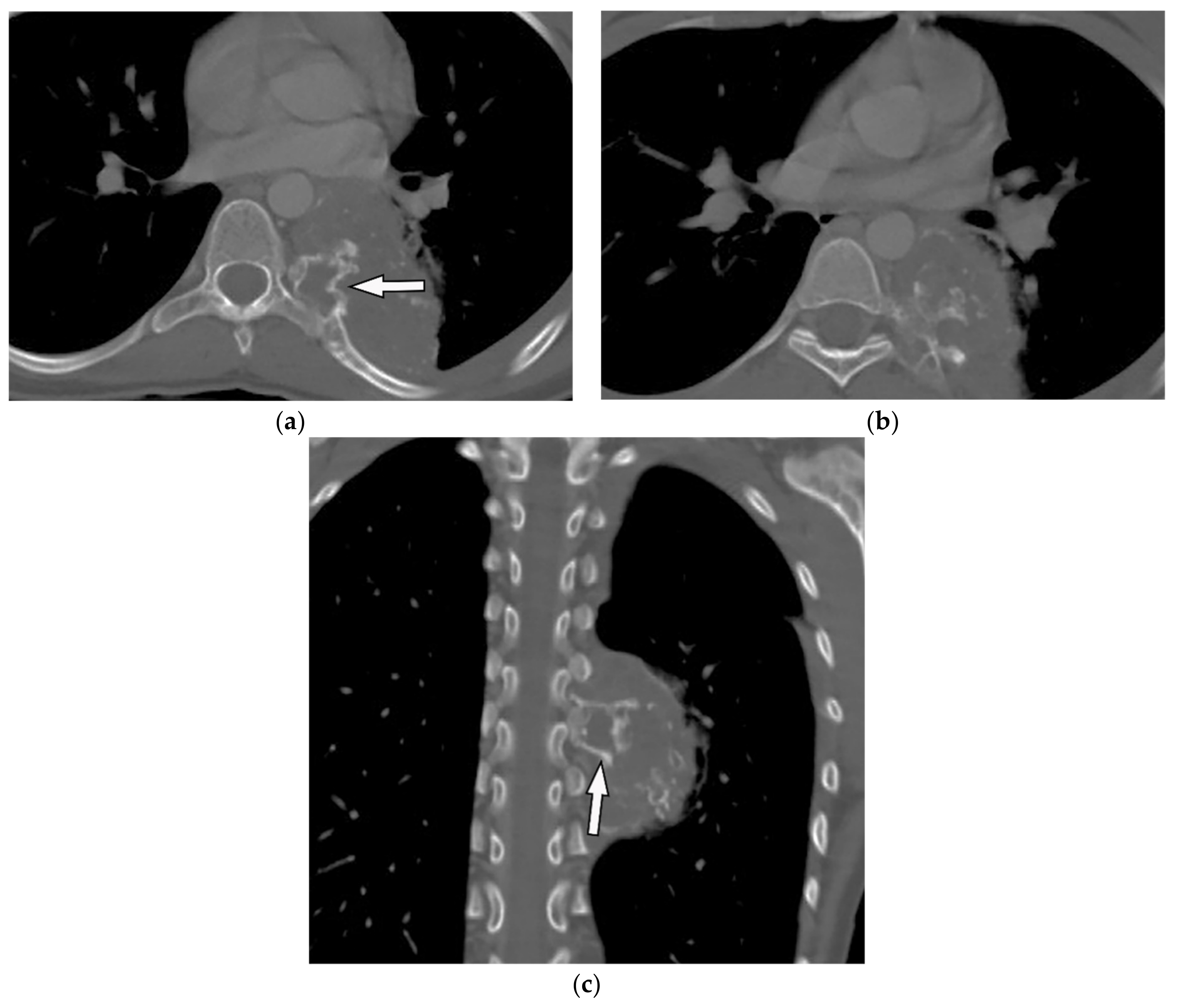 Diagnostics 12 00301 g003 Diagnostics 12 00301 g003