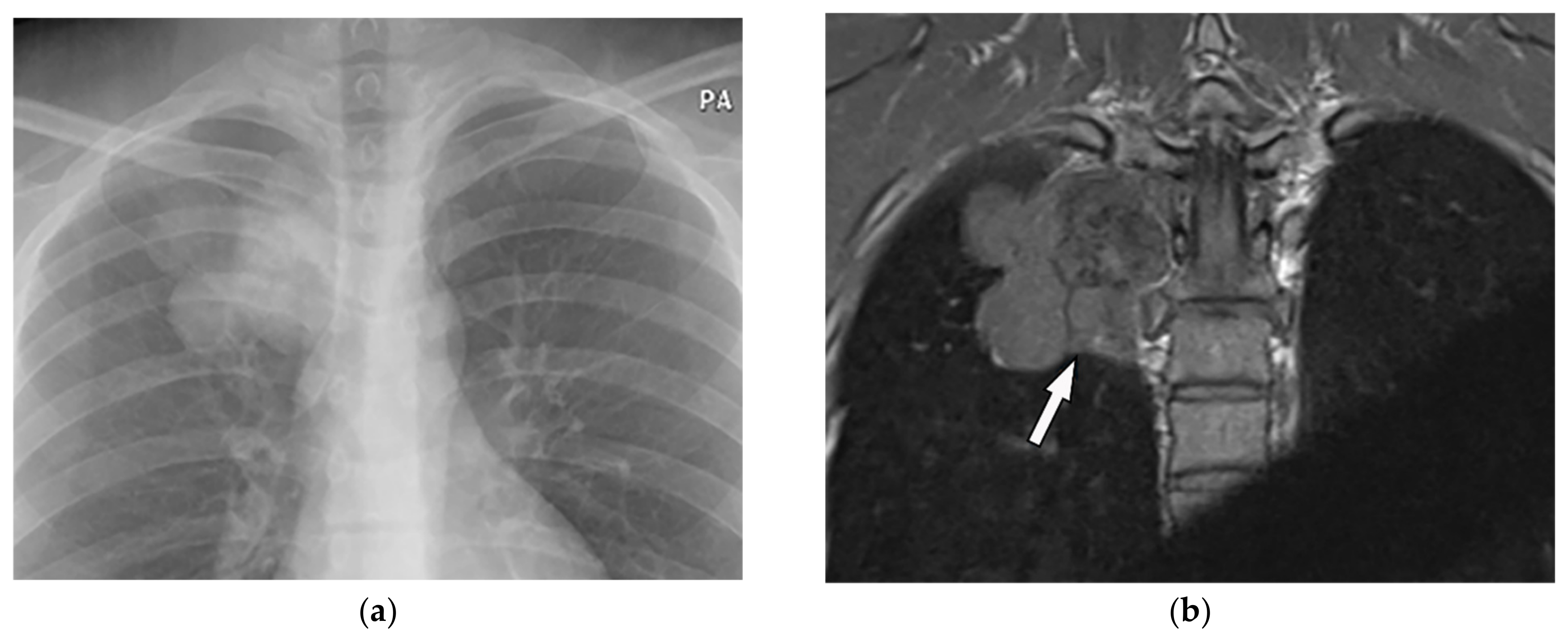 Diagnostics 12 00301 g005a Diagnostics 12 00301 g005a