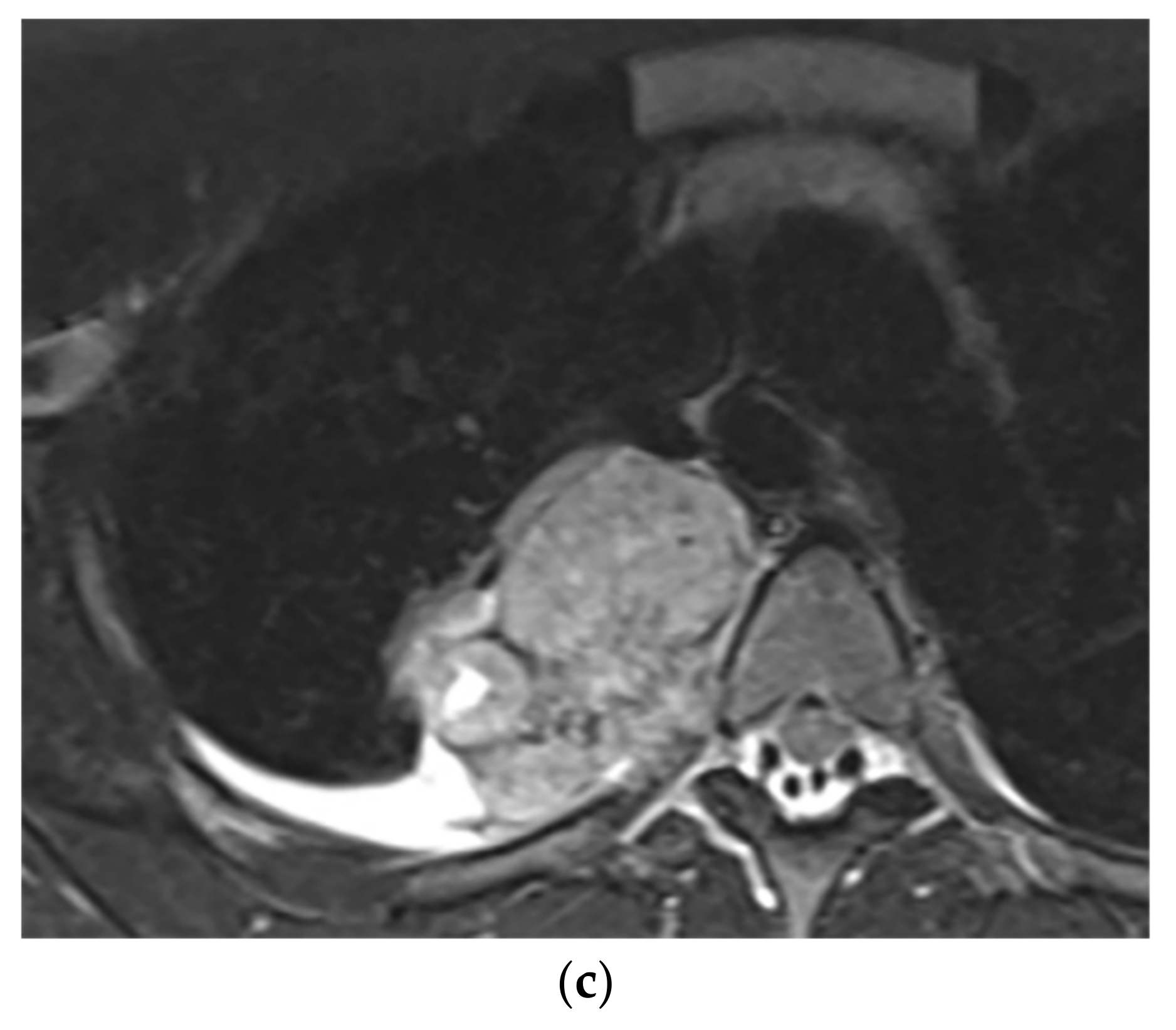 Diagnostics 12 00301 g005b Diagnostics 12 00301 g005b