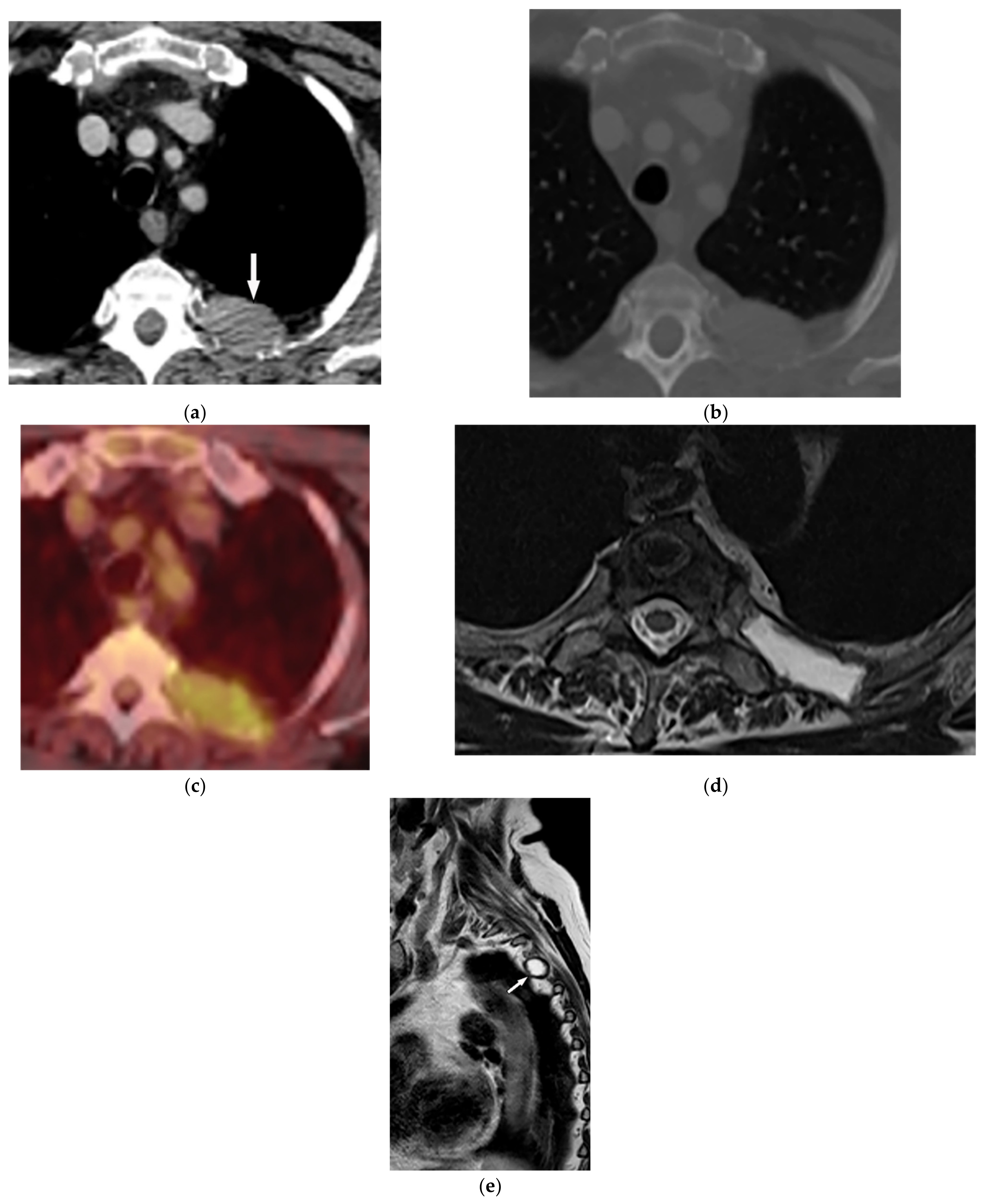 Diagnostics 12 00301 g006 Diagnostics 12 00301 g006