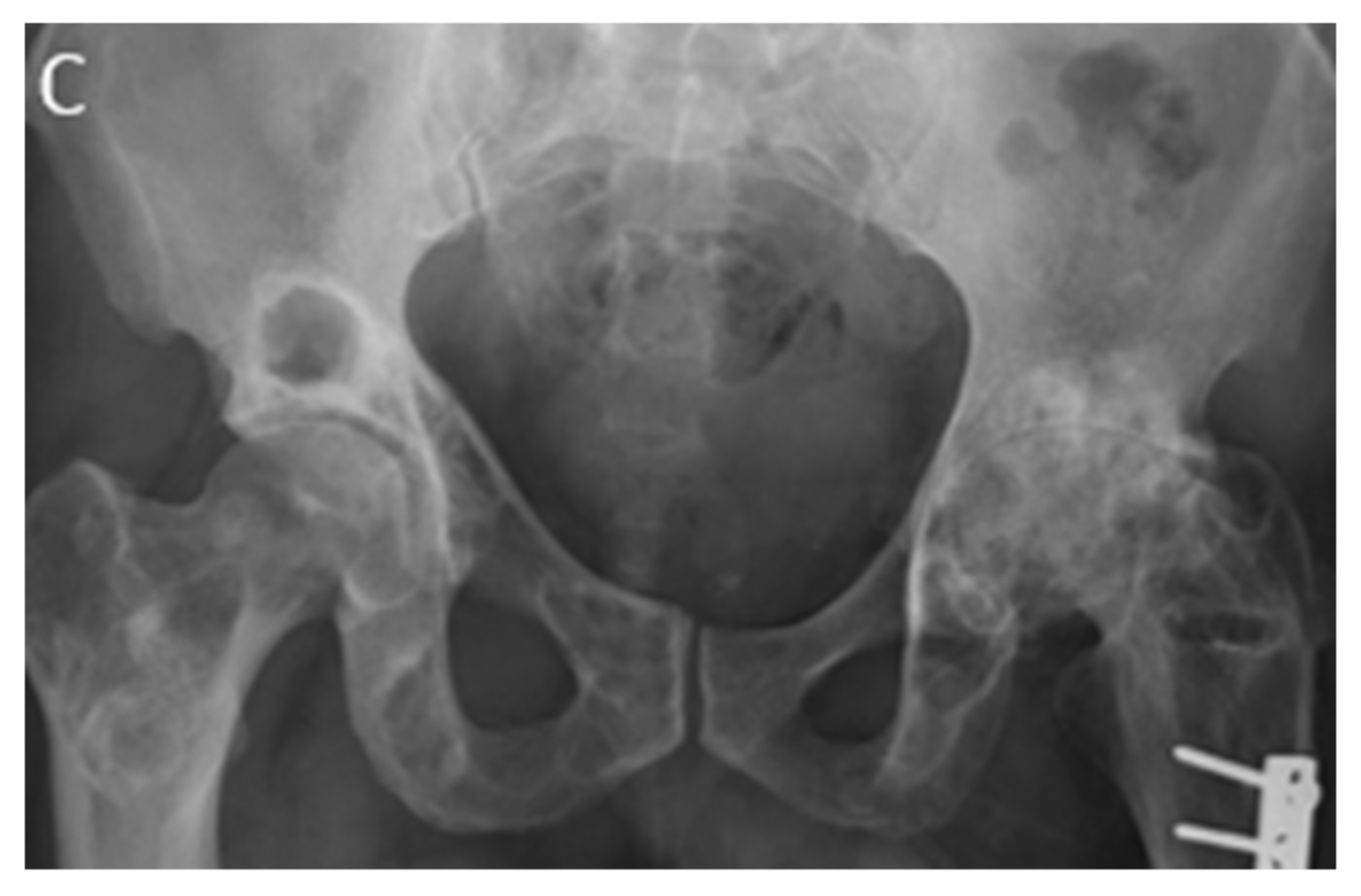 Diagnostics 12 00301 g008b Diagnostics 12 00301 g008b