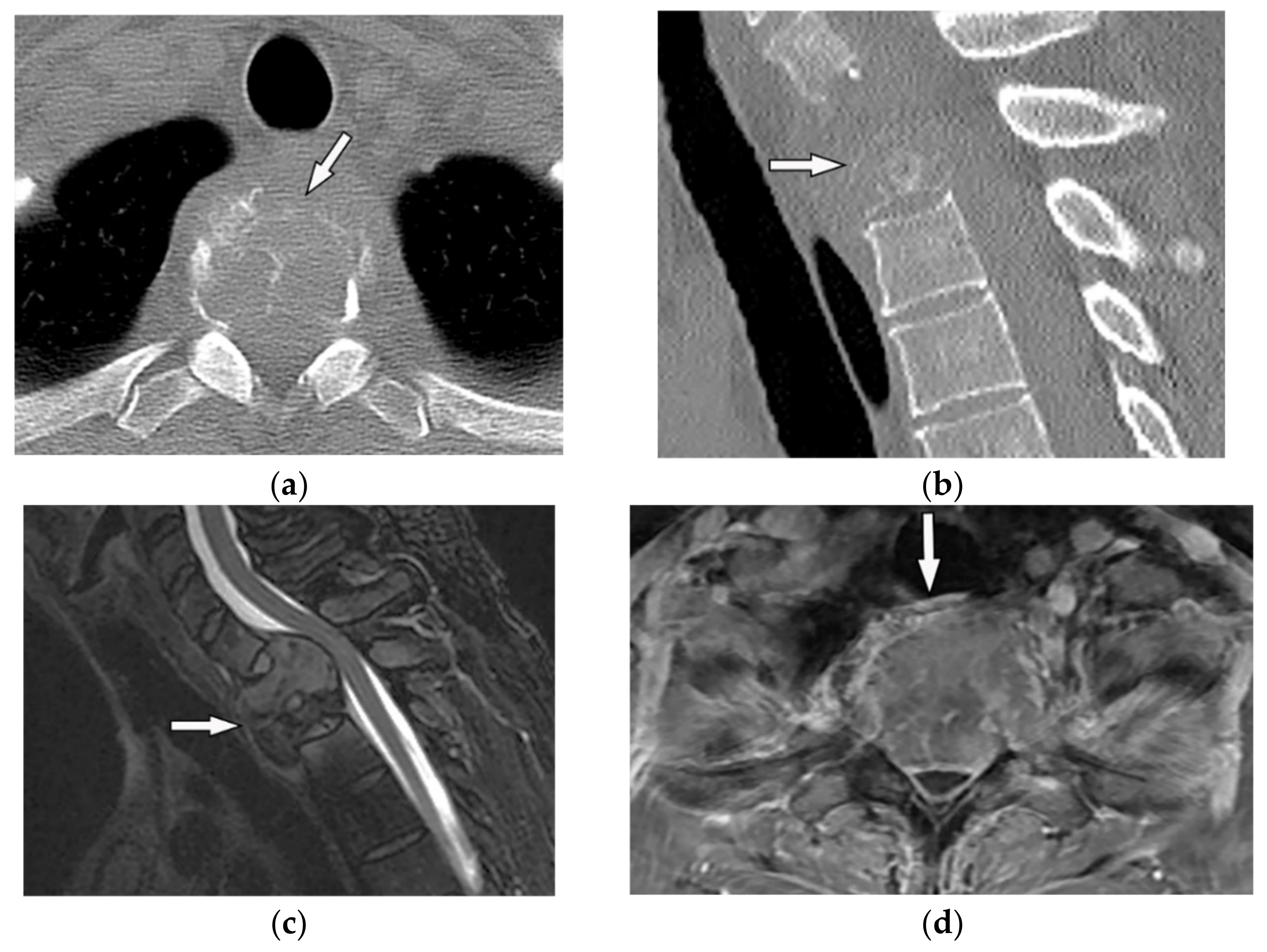 Diagnostics 12 00301 g009 Diagnostics 12 00301 g009